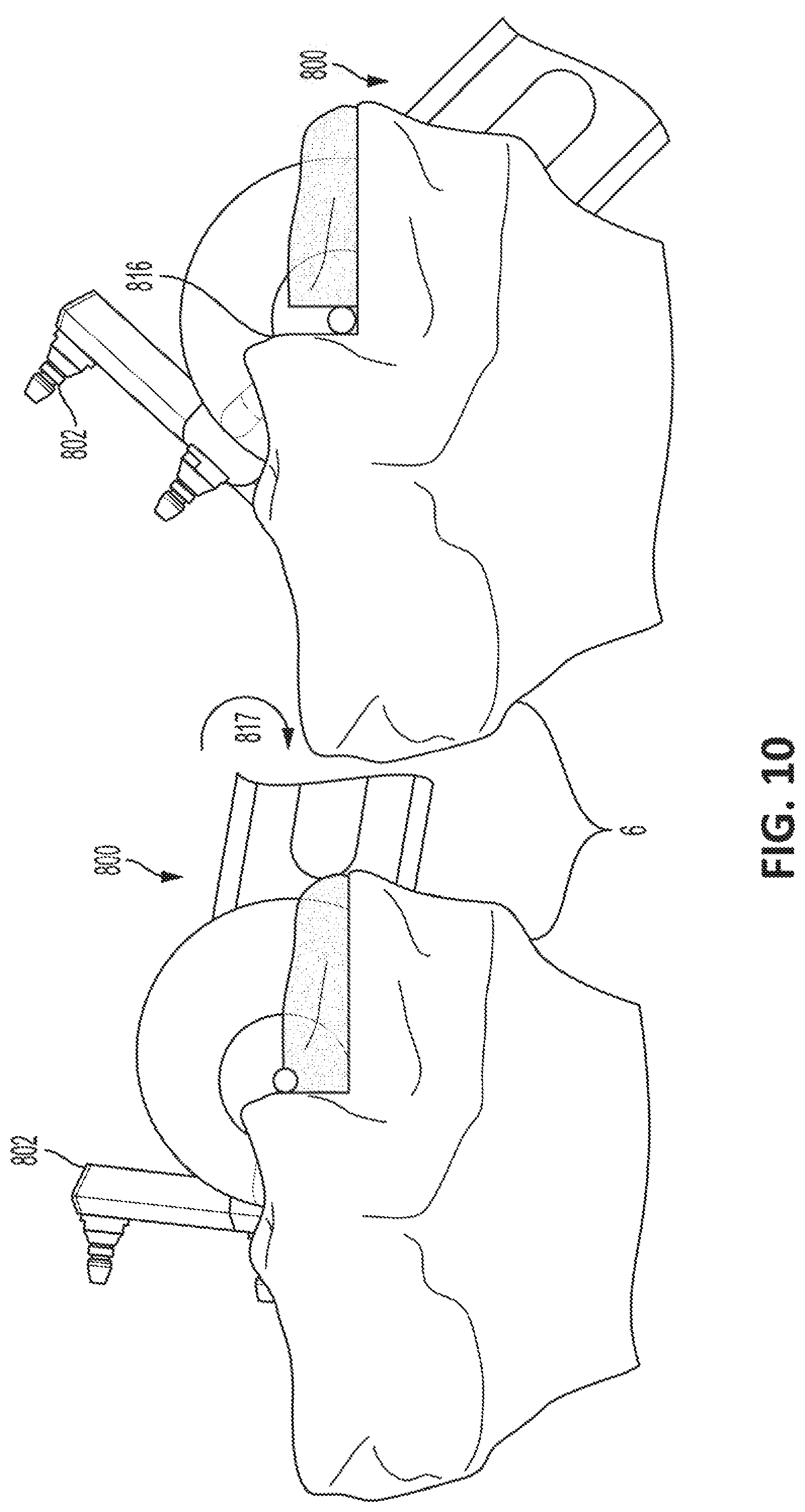 Patent US12310671 Figure 14 – Computer controlled surgical rotary tool