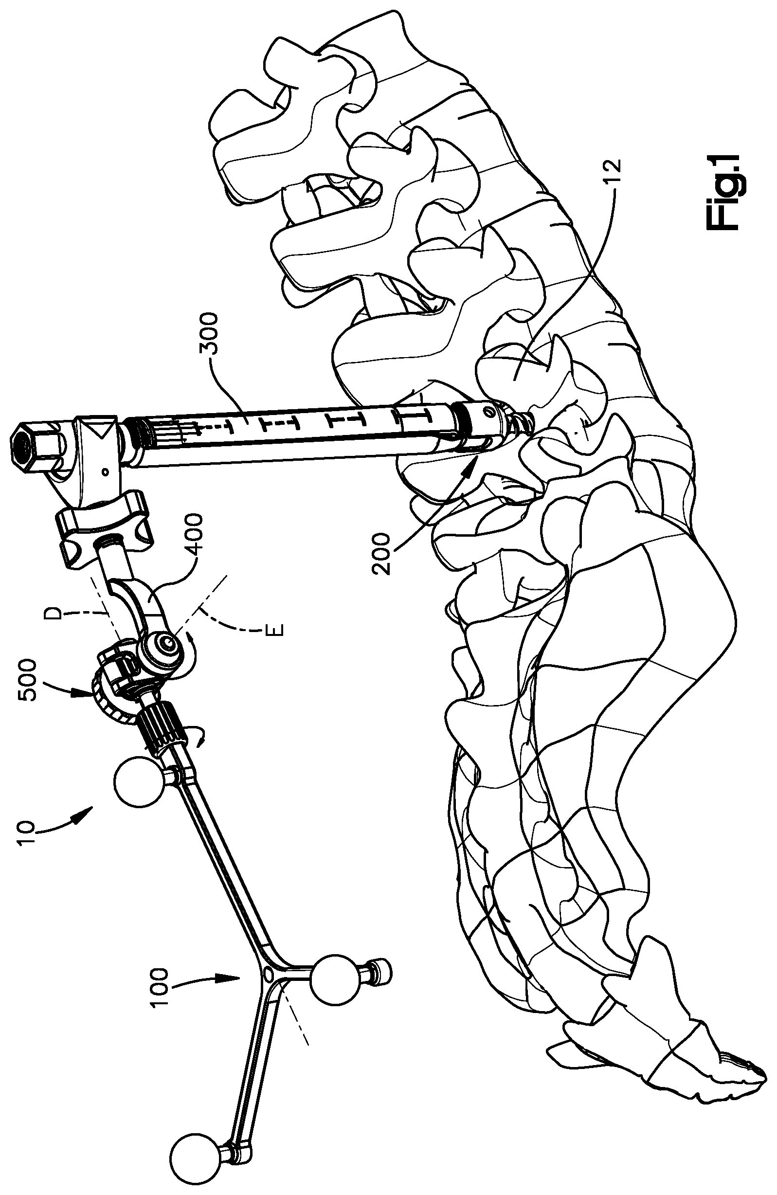 Patent US12310672 Figure 1 – Assembly for coupling a patient reference array to a medical implant such as a pedicle screw