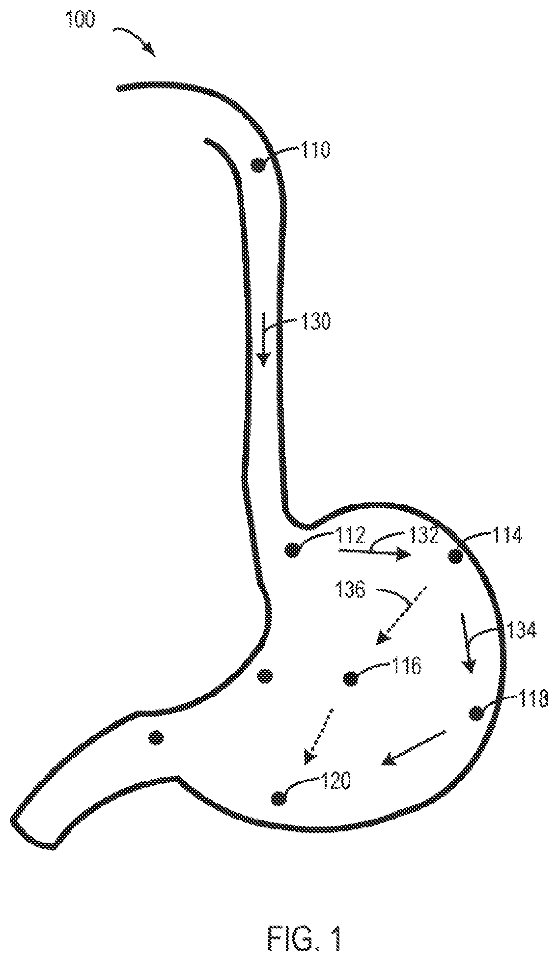 Patent US12310674 Figure 1 – Method, apparatus, device and computer storage medium for a medical assistance operation