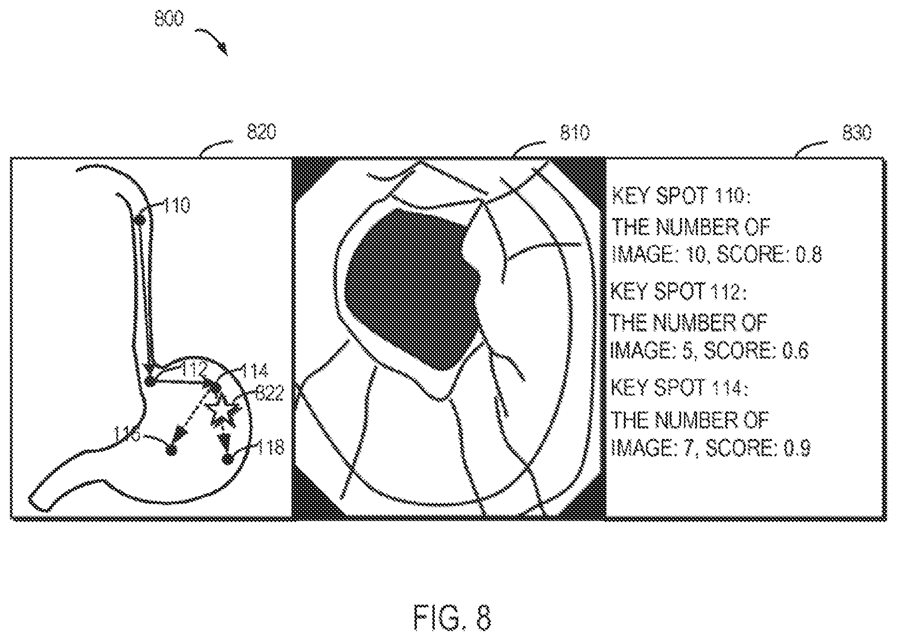 Patent US12310674 Figure 8 – Method, apparatus, device and computer storage medium for a medical assistance operation