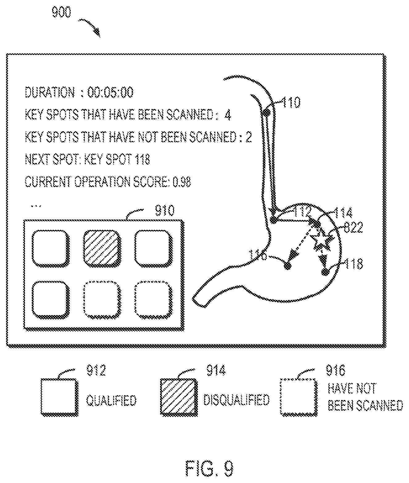 Patent US12310674 Figure 9 – Method, apparatus, device and computer storage medium for a medical assistance operation