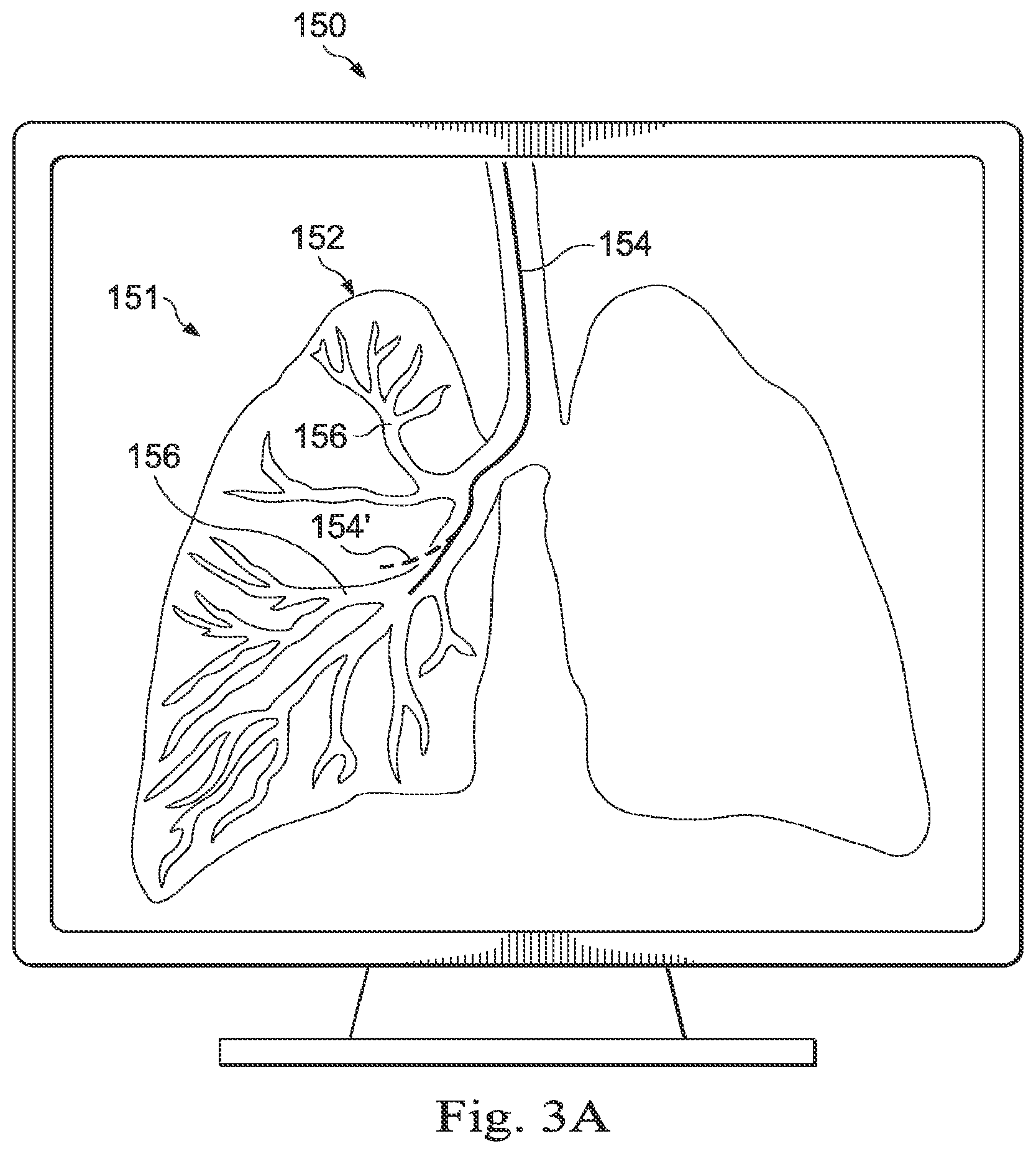 Patent US12310675 Figure 3 – Systems and methods for device-aware flexible tool registration