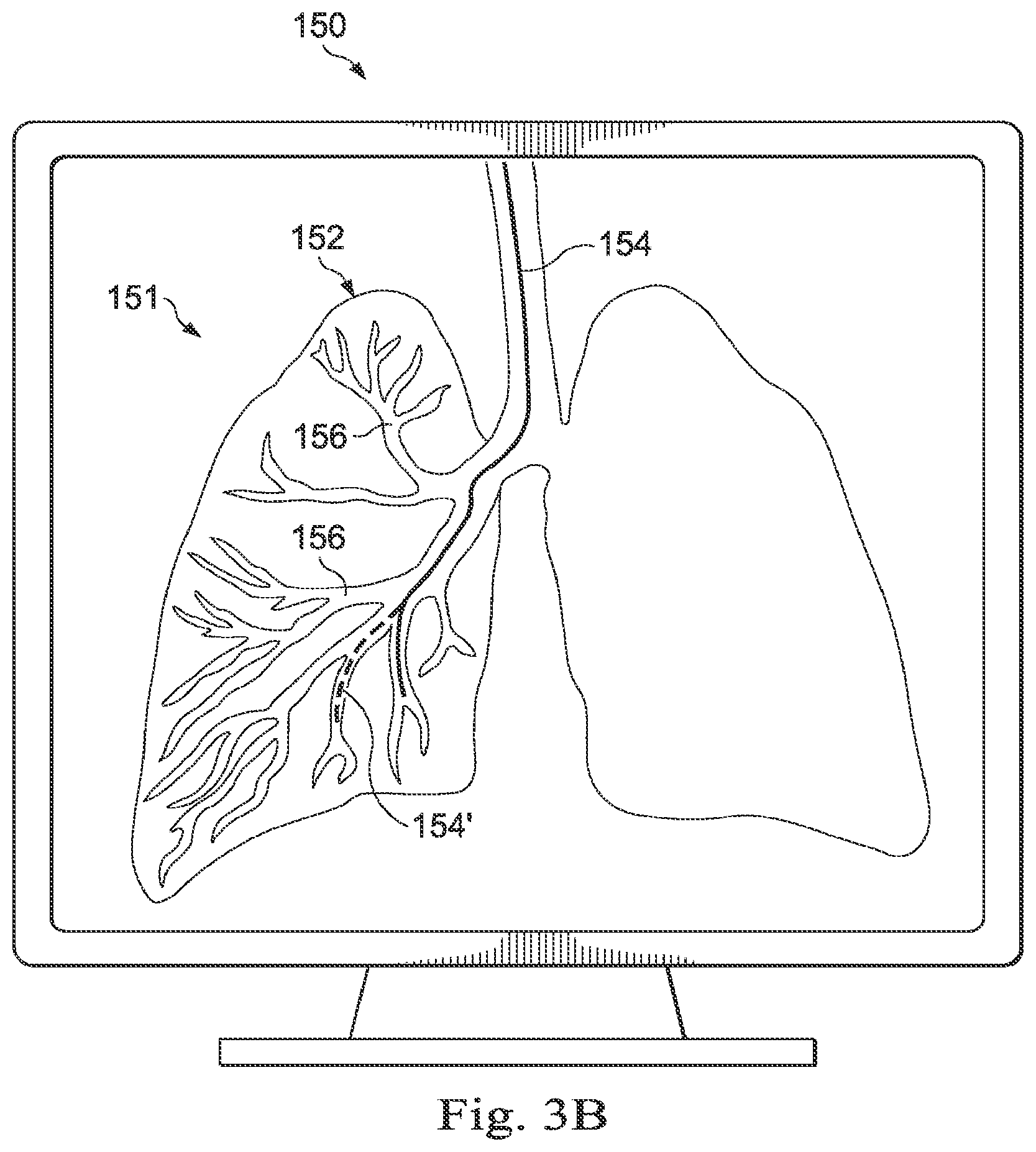 Patent US12310675 Figure 4 – Systems and methods for device-aware flexible tool registration