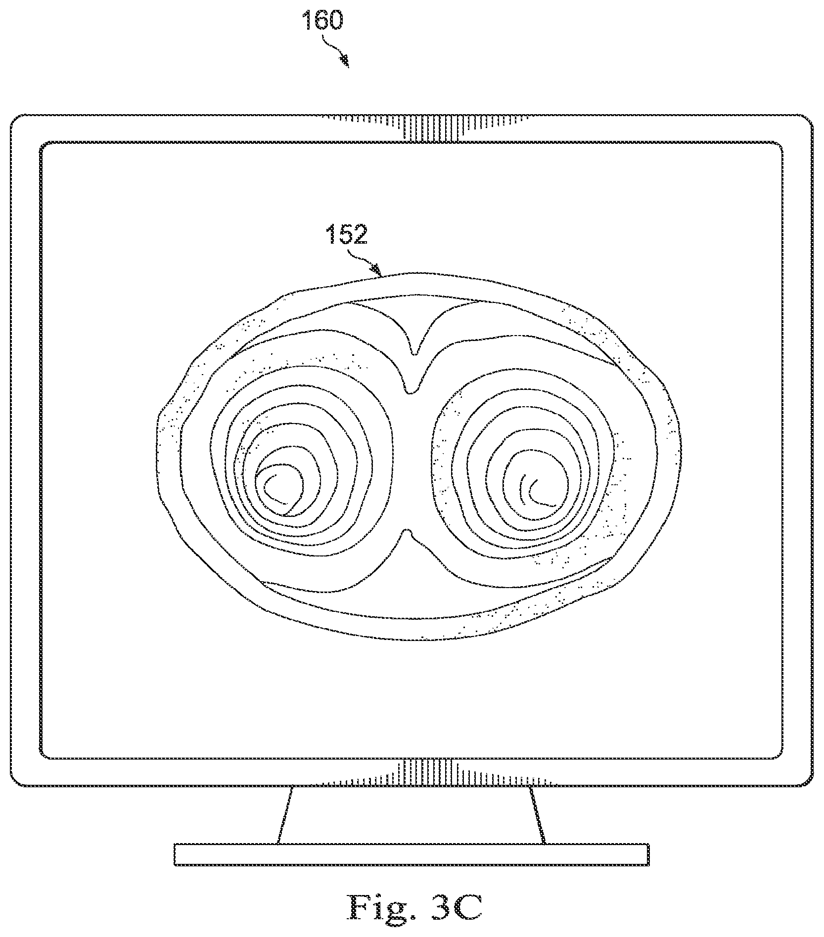 Patent US12310675 Figure 5 – Systems and methods for device-aware flexible tool registration