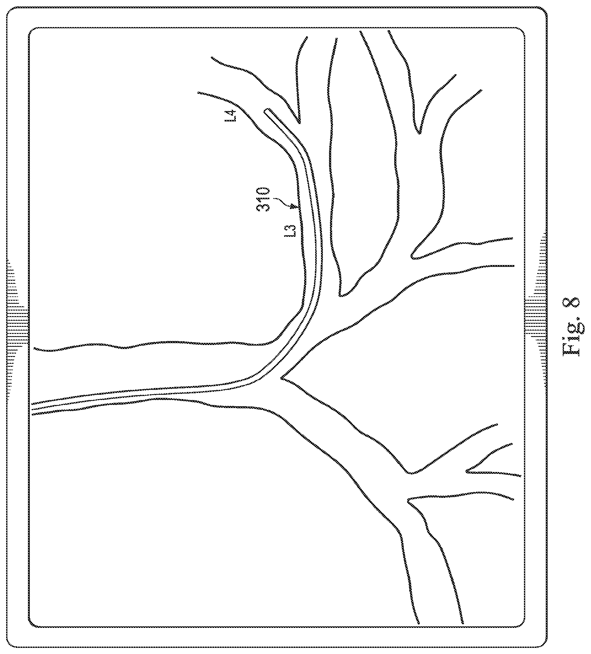 Patent US12310675 Figure 17 – Systems and methods for device-aware flexible tool registration