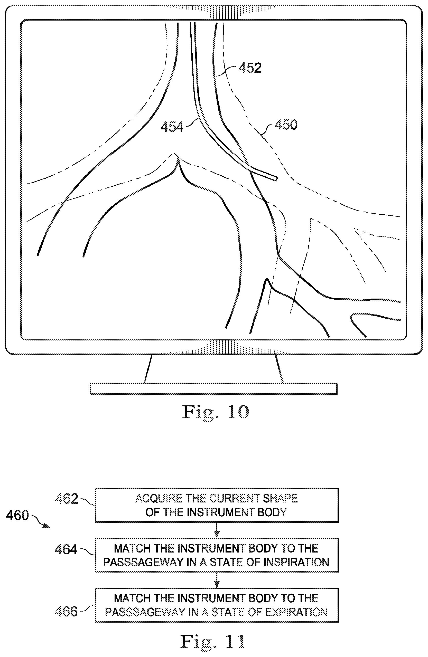 Patent US12310675 Figure 19 – Systems and methods for device-aware flexible tool registration