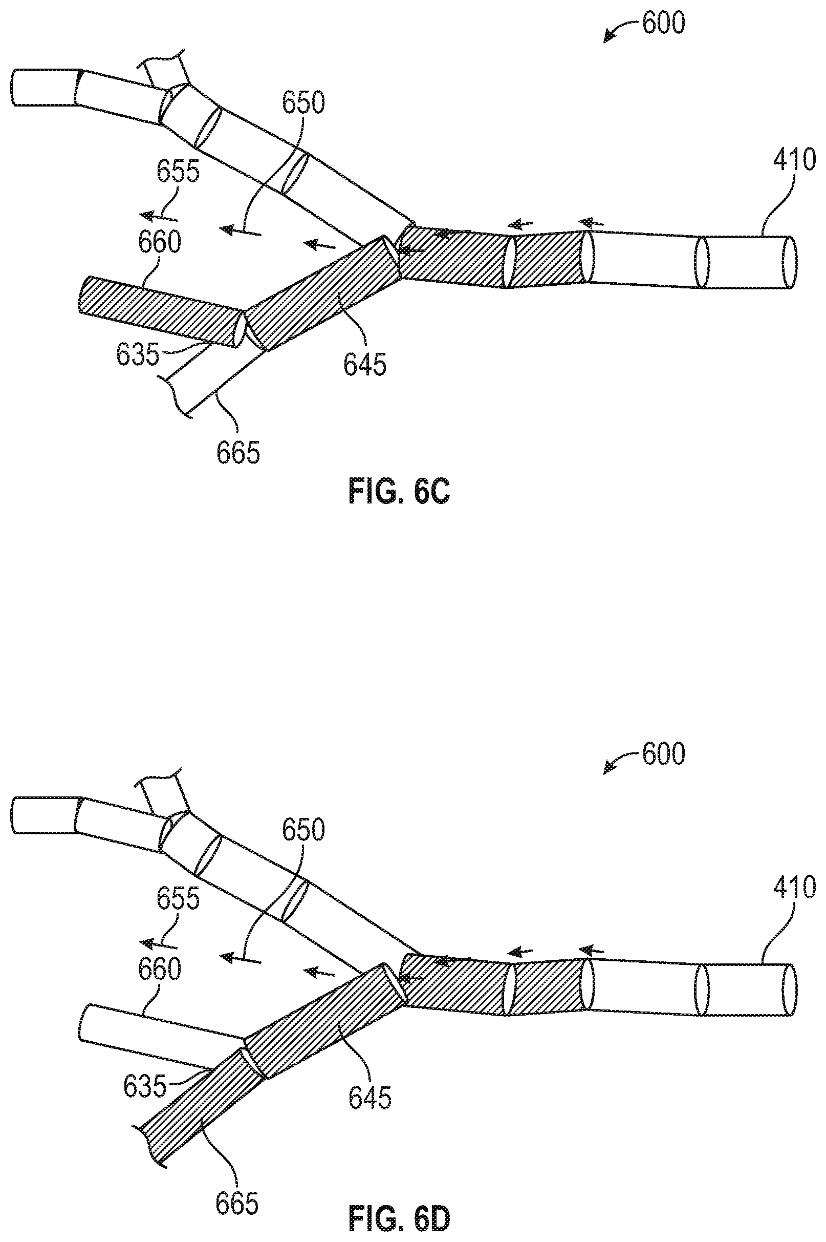 Patent US12310677 Figure 5 – Deformable registration of computer-generated airway models to airway trees