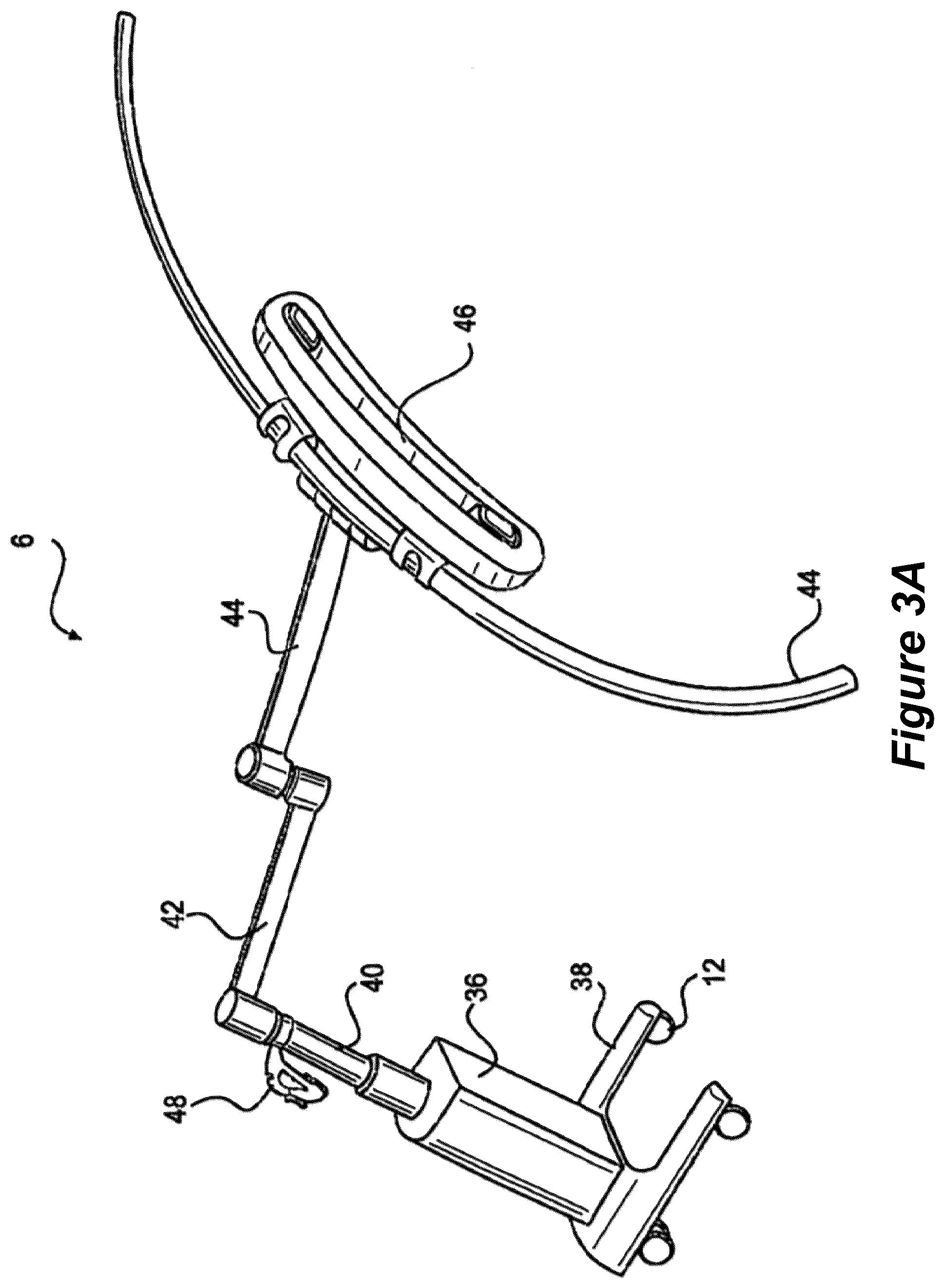 Patent US12310678 Figure 3 – Pose measurement chaining for extended reality surgical navigation in visible and near infrared spectrums