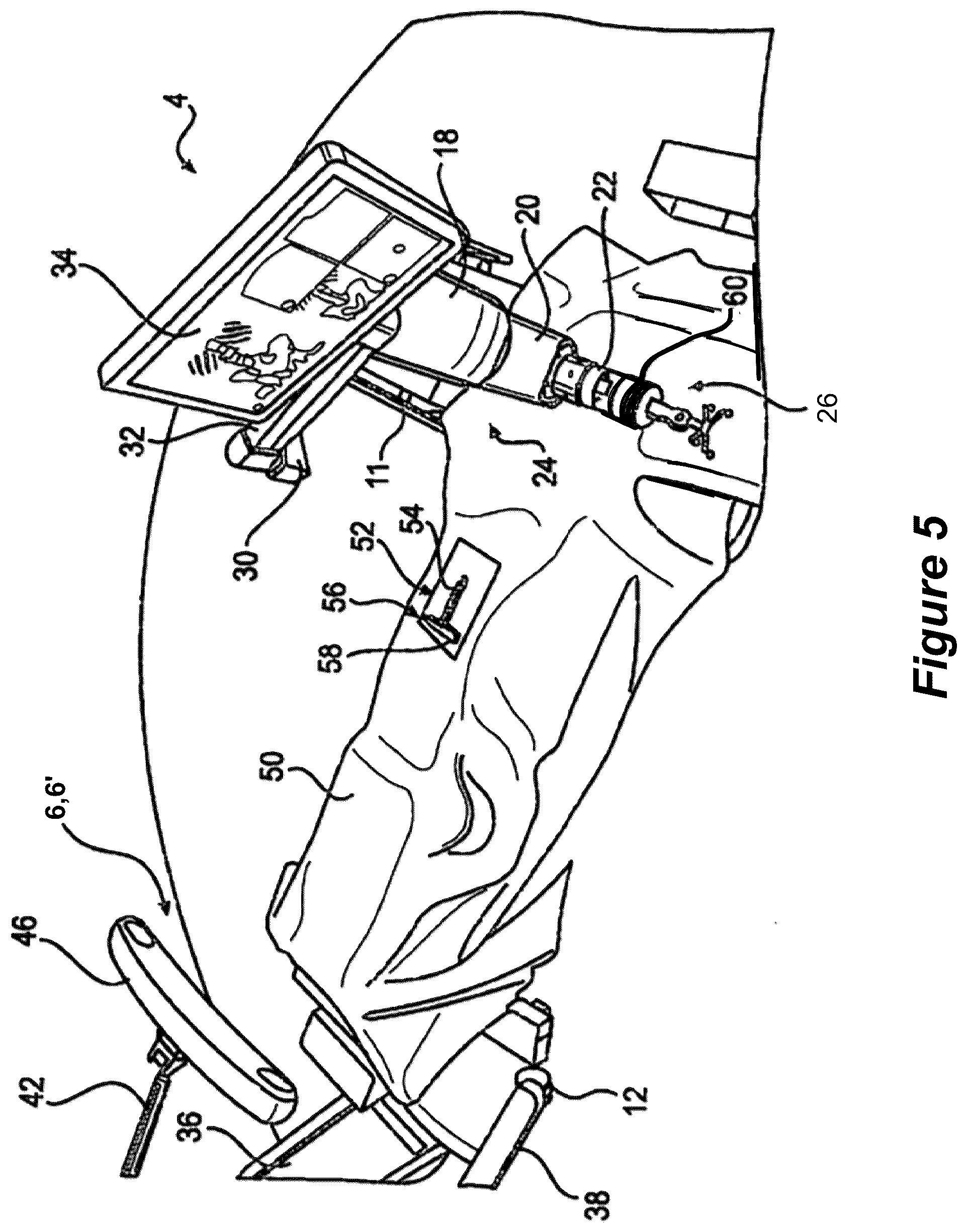 Patent US12310678 Figure 6 – Pose measurement chaining for extended reality surgical navigation in visible and near infrared spectrums
