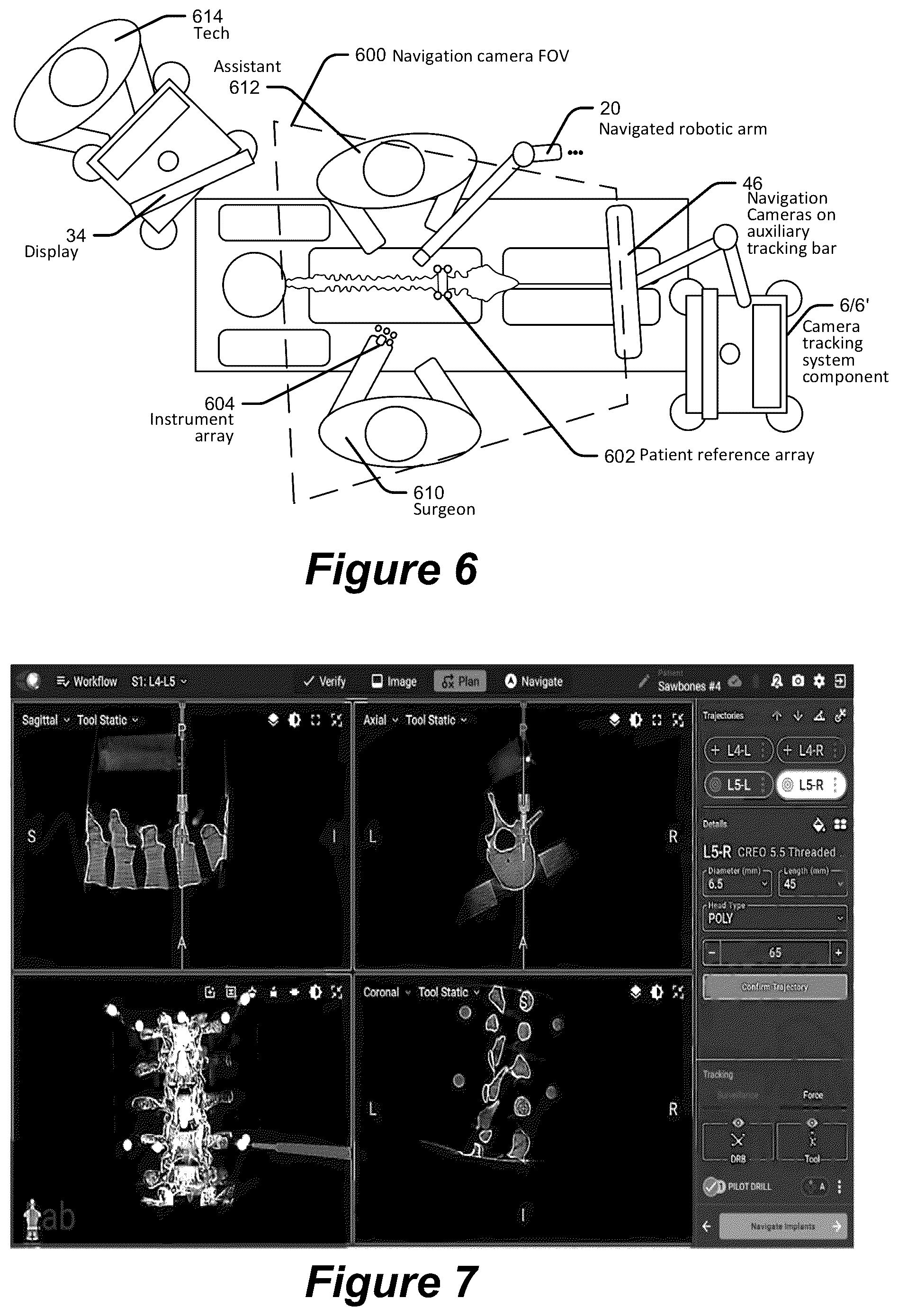Patent US12310678 Figure 7 – Pose measurement chaining for extended reality surgical navigation in visible and near infrared spectrums