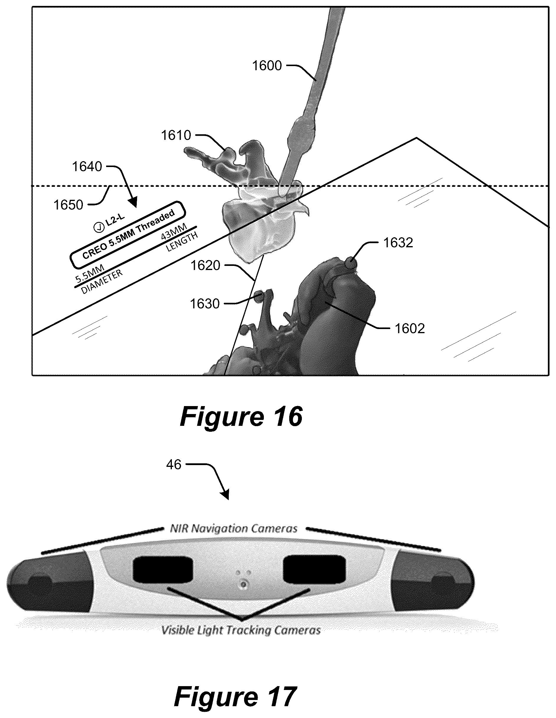 Patent US12310678 Figure 15 – Pose measurement chaining for extended reality surgical navigation in visible and near infrared spectrums