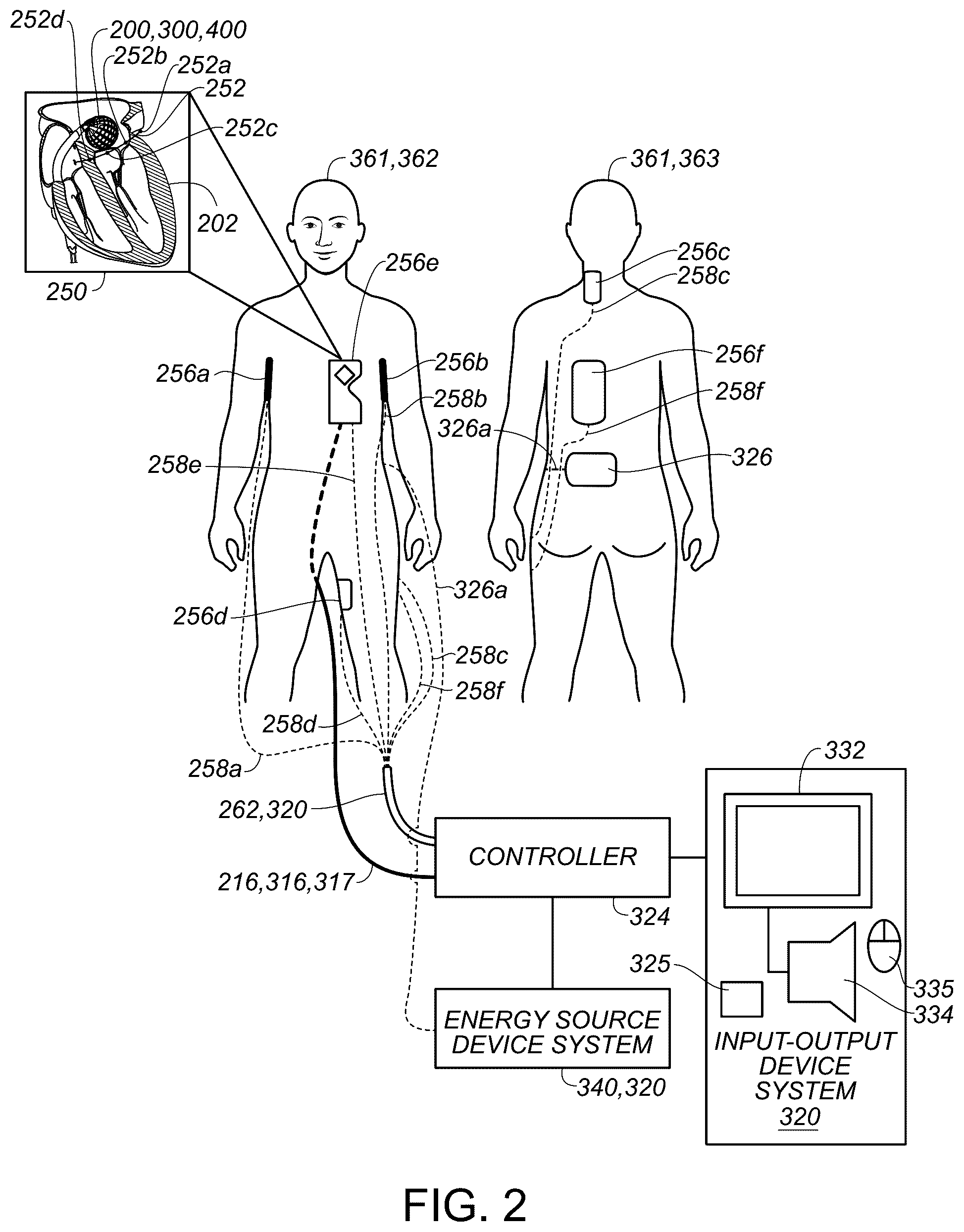 Patent US12310680 Figure 2 – Catheter navigation systems and methods