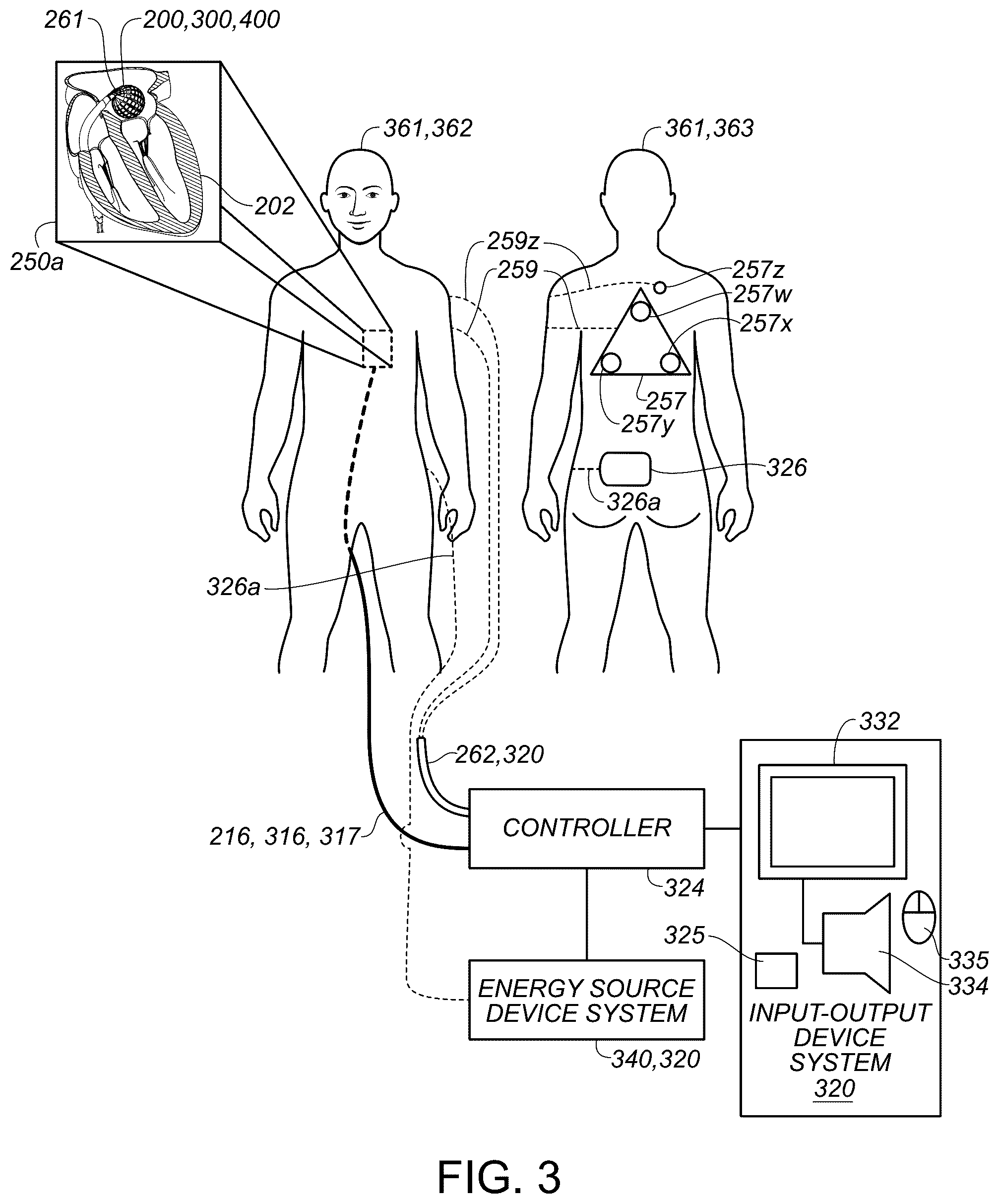 Patent US12310680 Figure 3 – Catheter navigation systems and methods