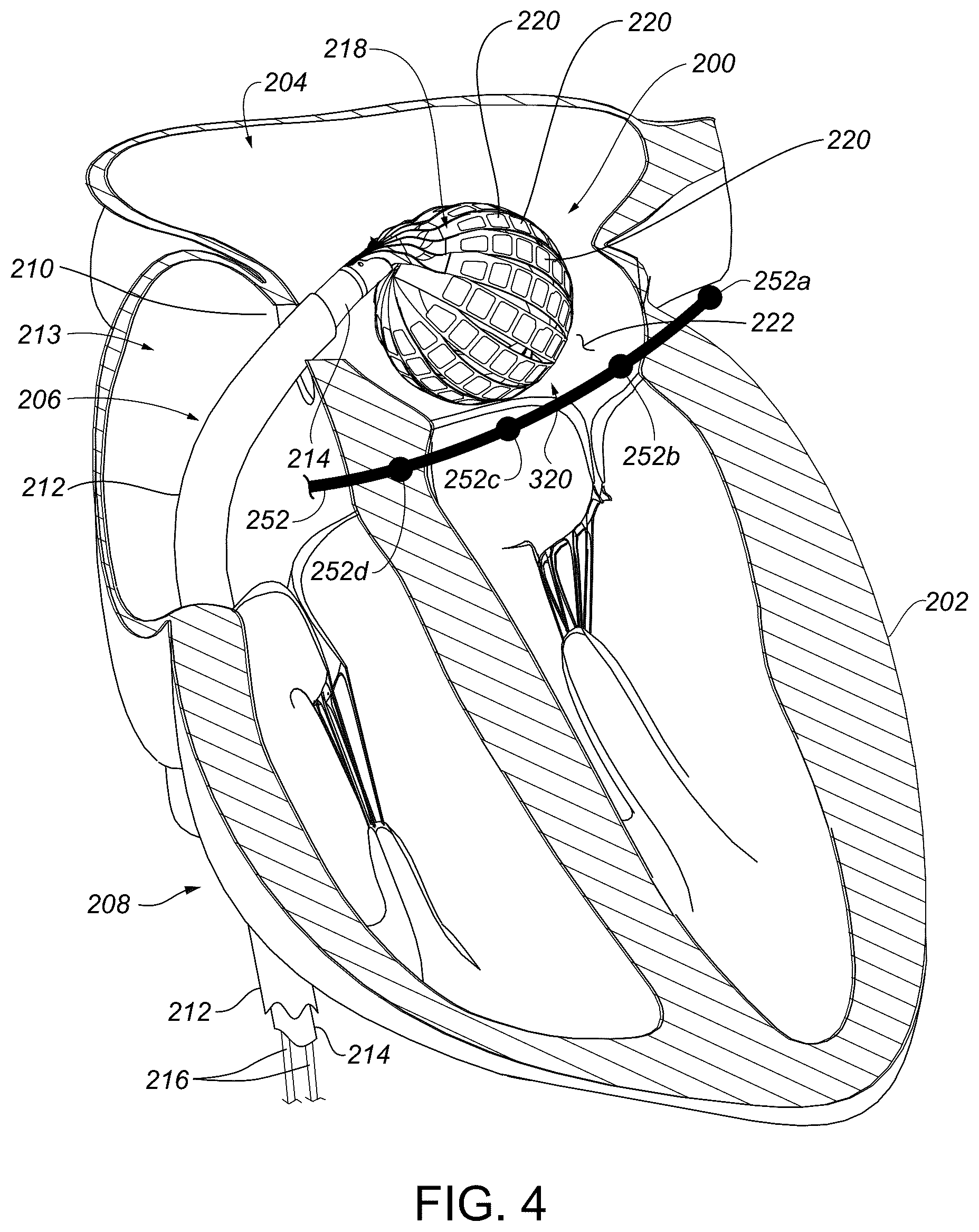 Patent US12310680 Figure 4 – Catheter navigation systems and methods