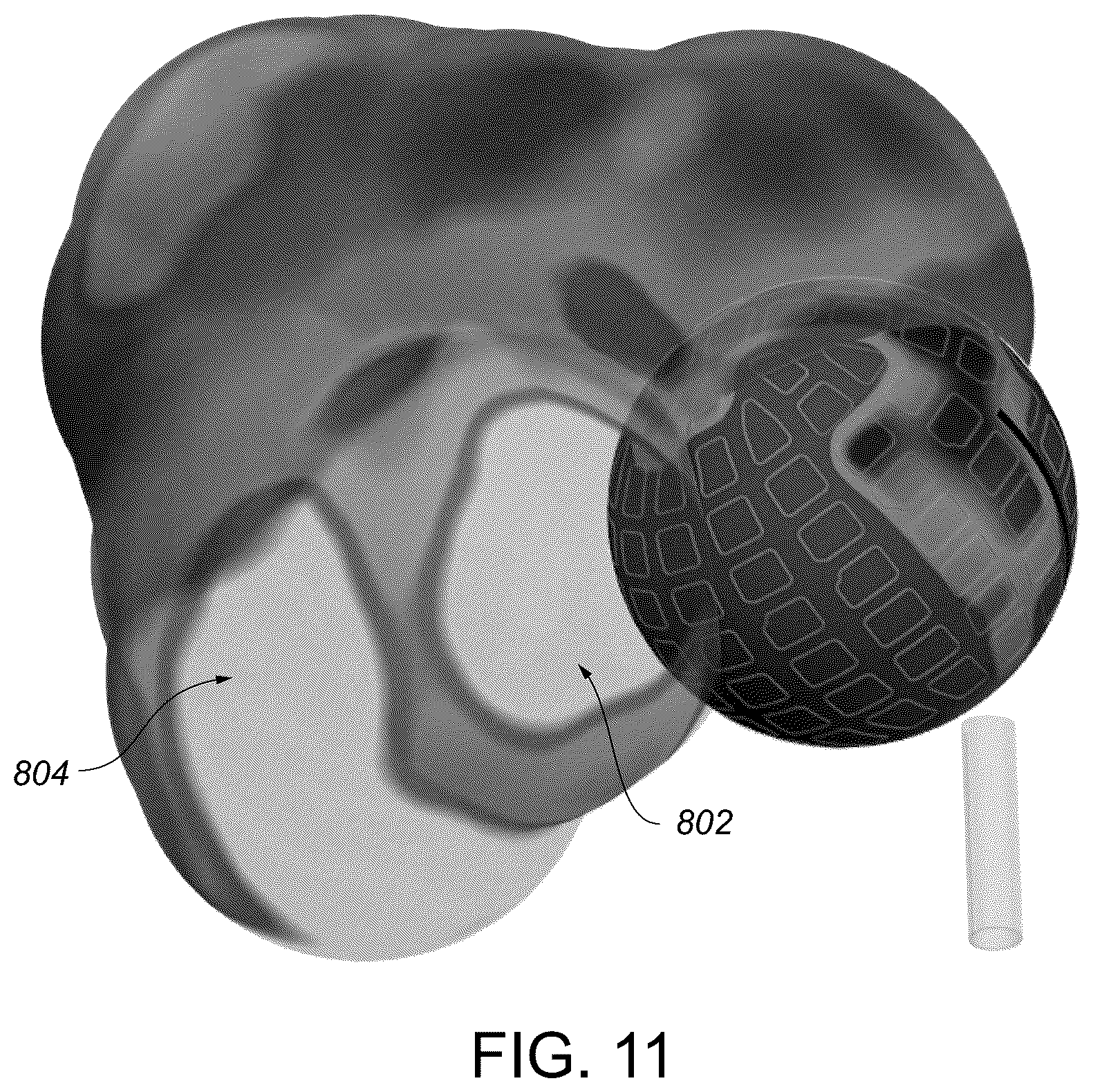 Patent US12310680 Figure 11 – Catheter navigation systems and methods