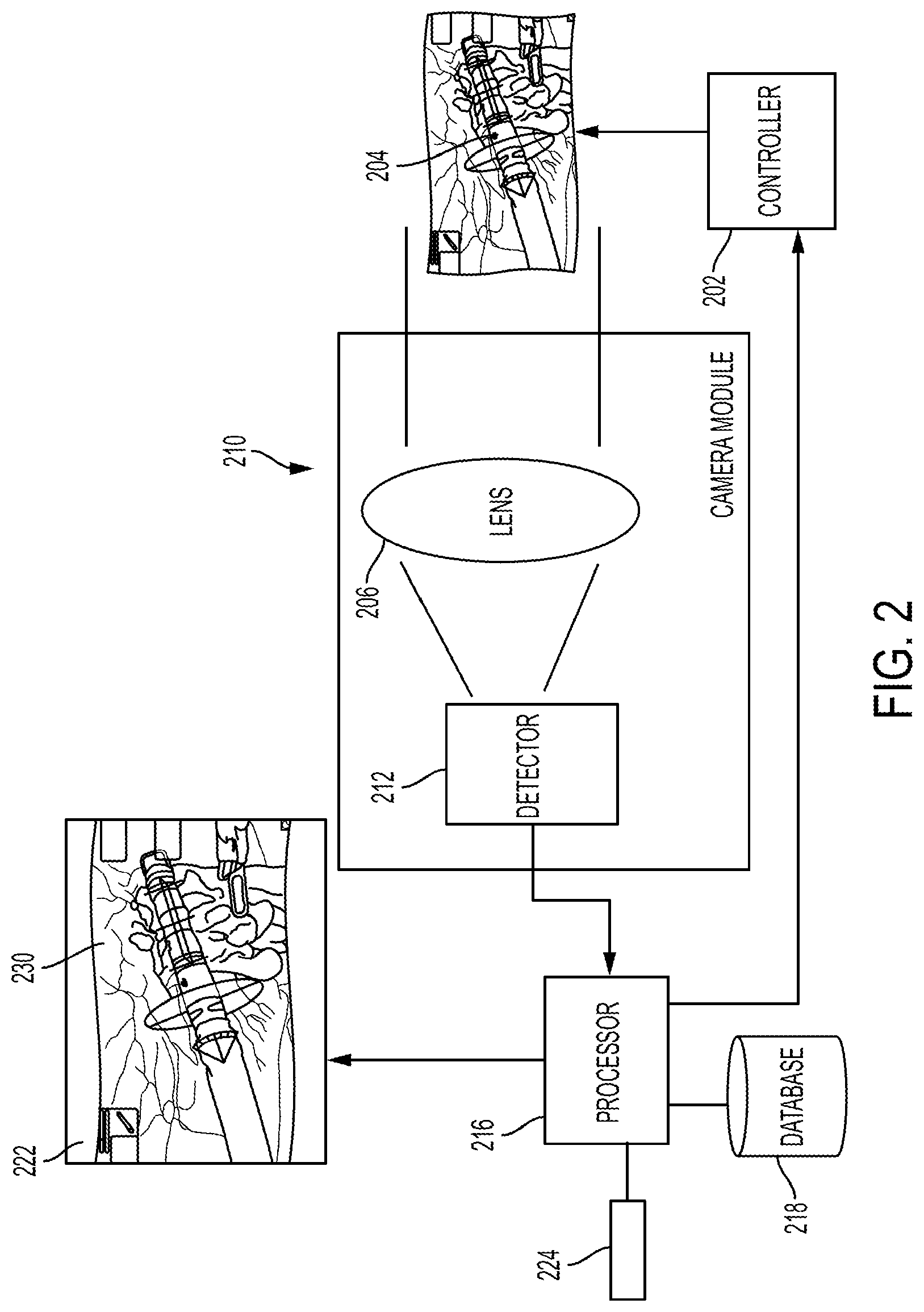 Patent US12310681 Figure 2 – Surgical system with augmented reality display