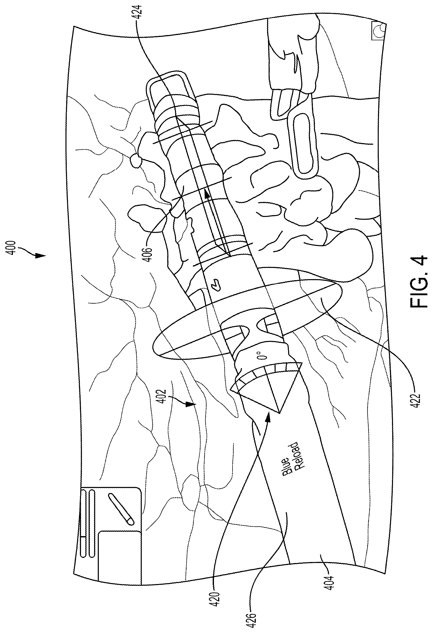 Patent US12310681 Figure 4 – Surgical system with augmented reality display