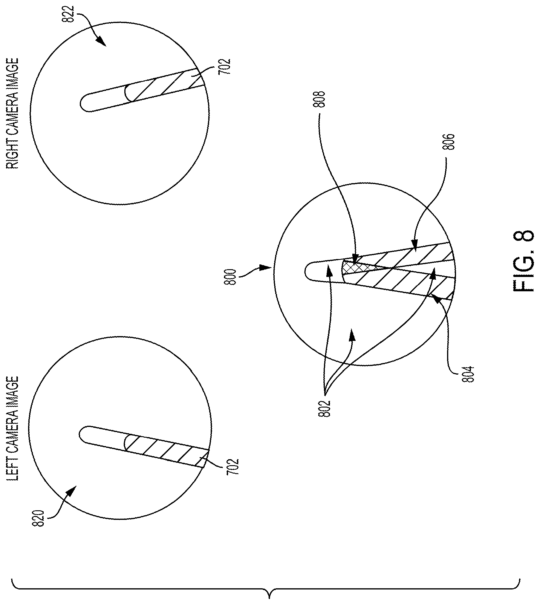 Patent US12310681 Figure 8 – Surgical system with augmented reality display