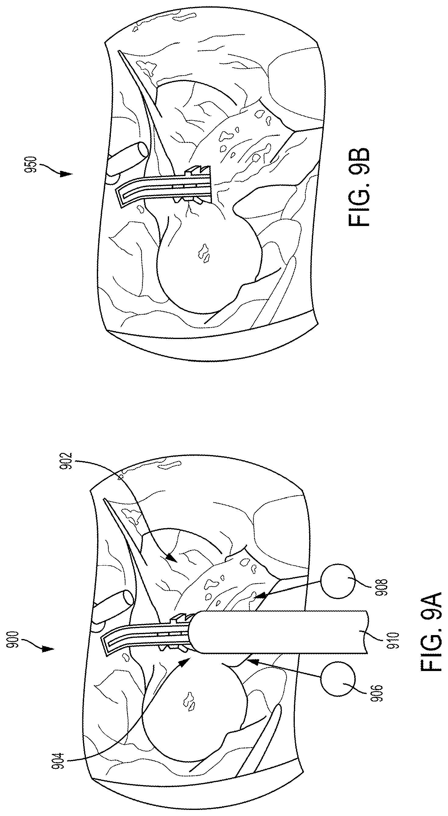 Patent US12310681 Figure 9 – Surgical system with augmented reality display