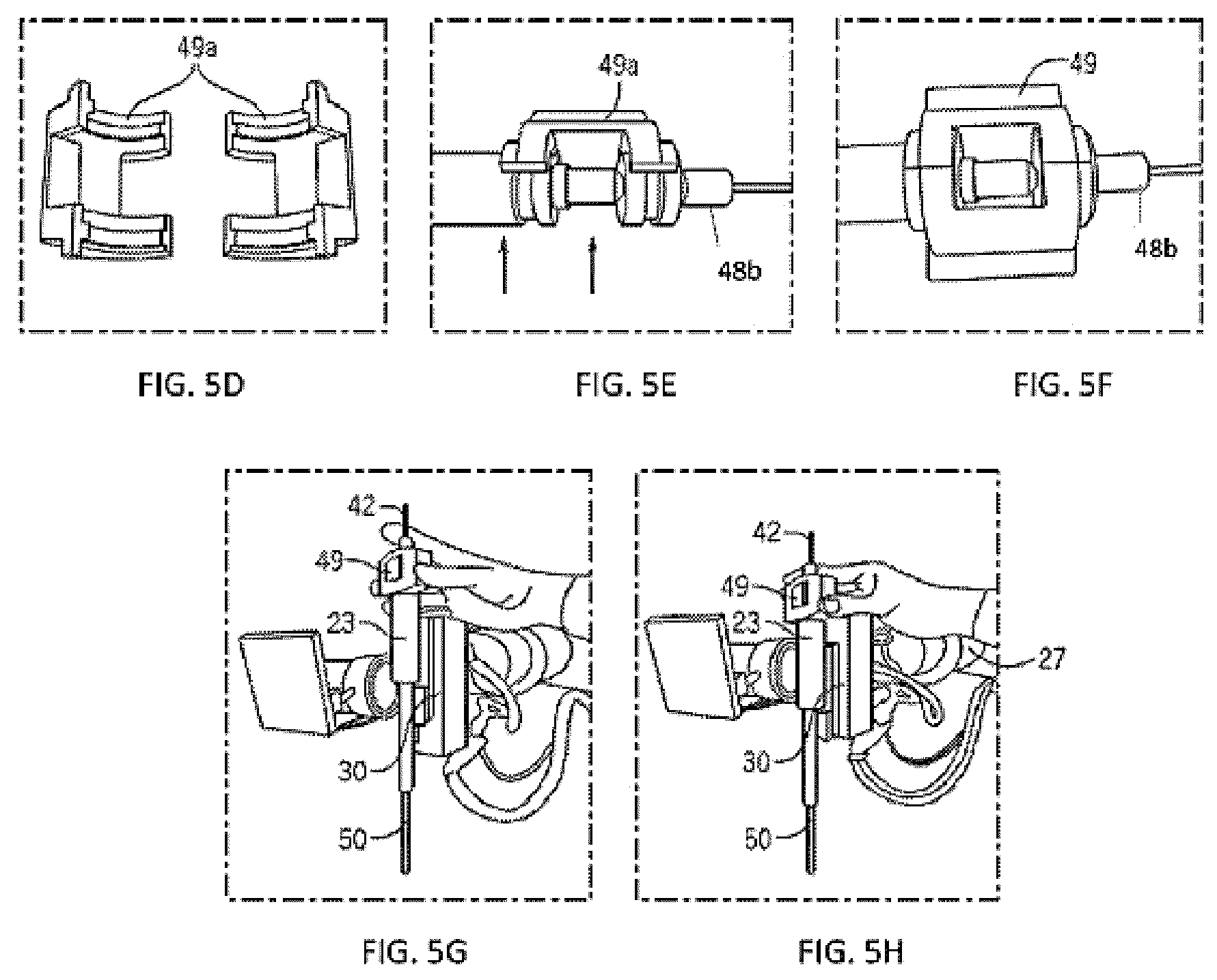 Patent US12310683 Figure 12 – Surgical tool systems and method