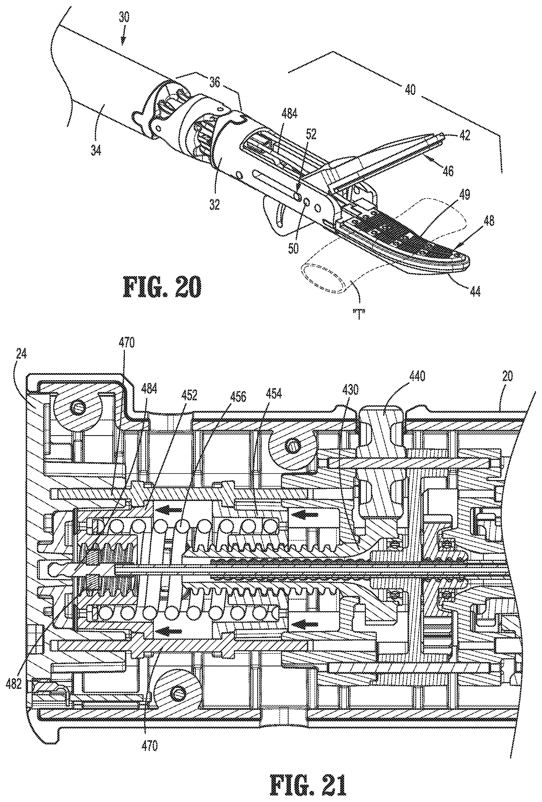 Patent US12310685 Figure 17 – Drive mechanisms for surgical instruments such as for use in robotic surgical systems