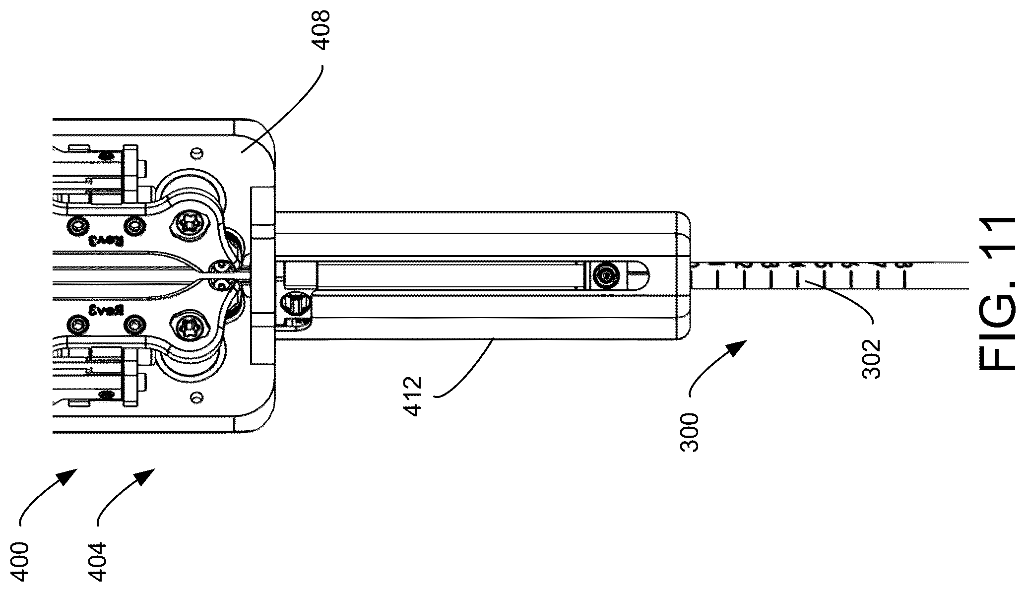 Patent US12310688 Figure 11 – Robotic delivery system for cardiac implants