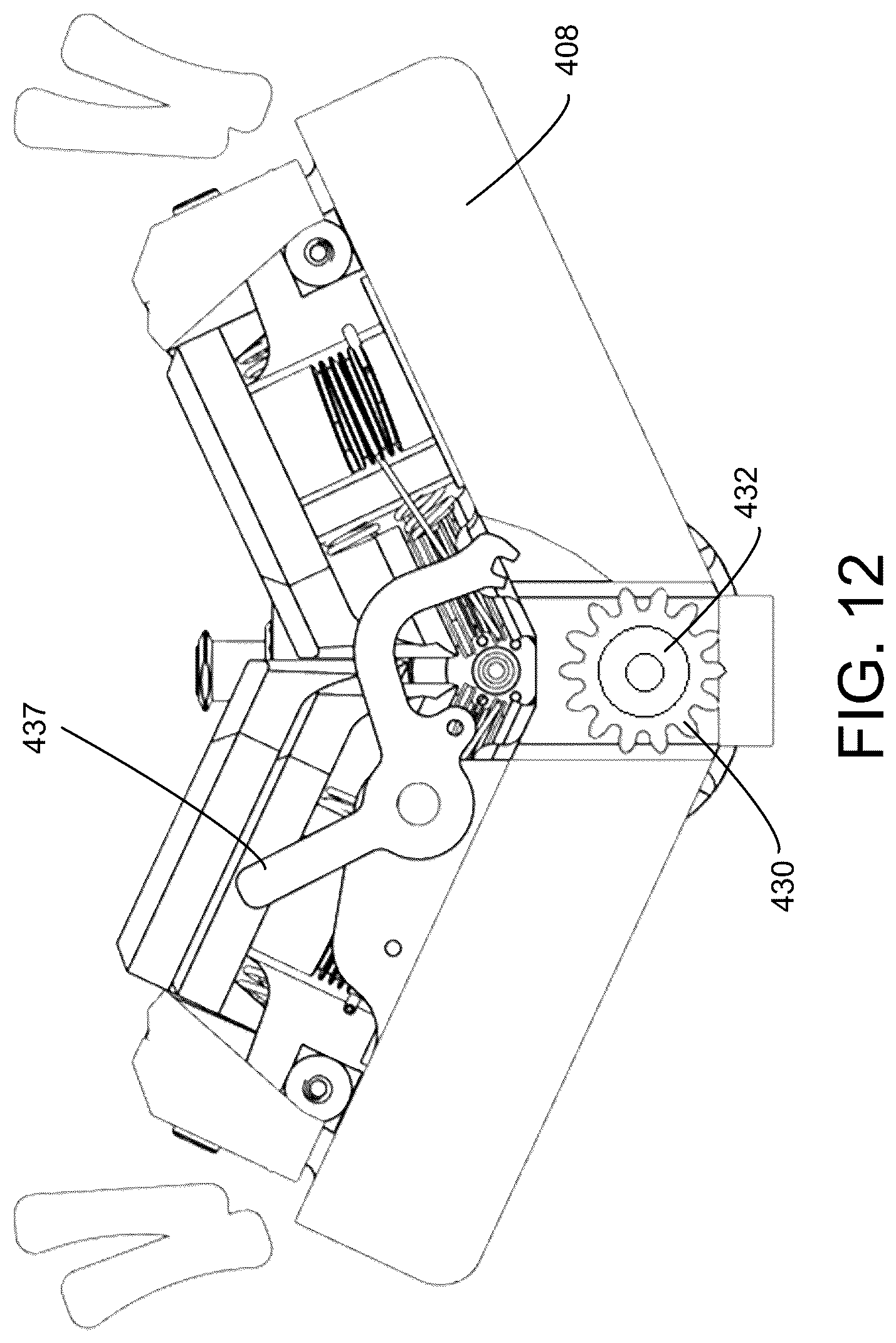 Patent US12310688 Figure 12 – Robotic delivery system for cardiac implants