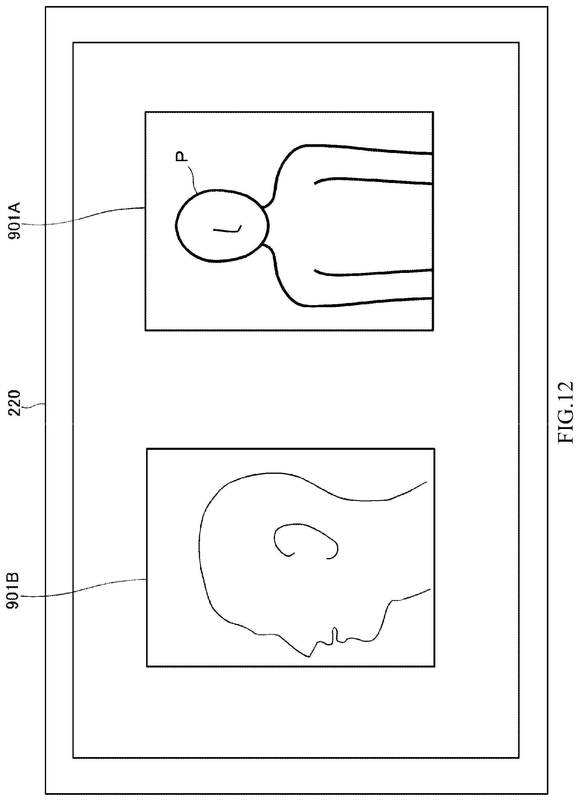 Patent US12310689 Figure 12 – Diagnosis/treatment support robot, diagnosis/treatment support robot system, and diagnosis/treatment support method