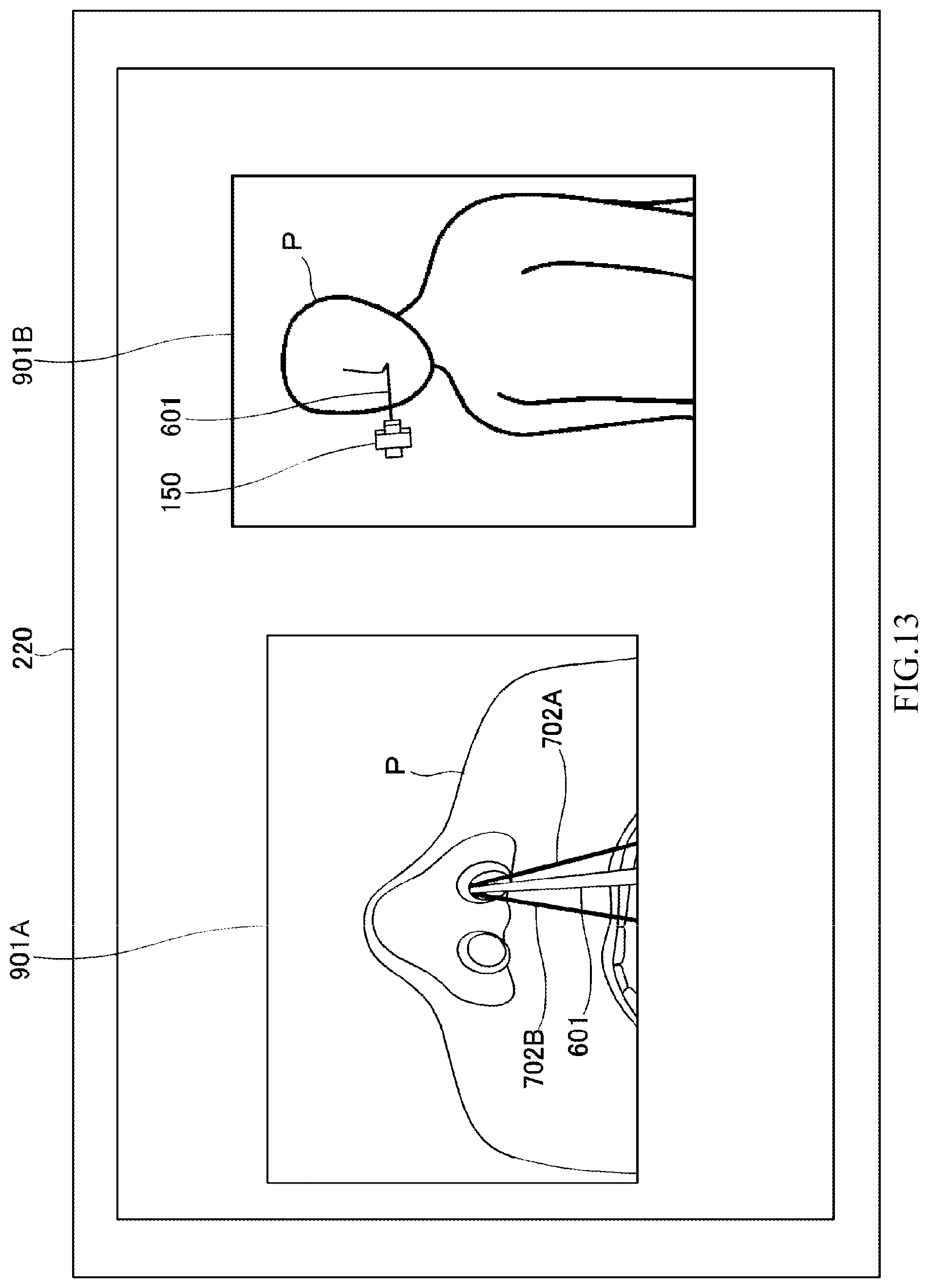 Patent US12310689 Figure 13 – Diagnosis/treatment support robot, diagnosis/treatment support robot system, and diagnosis/treatment support method