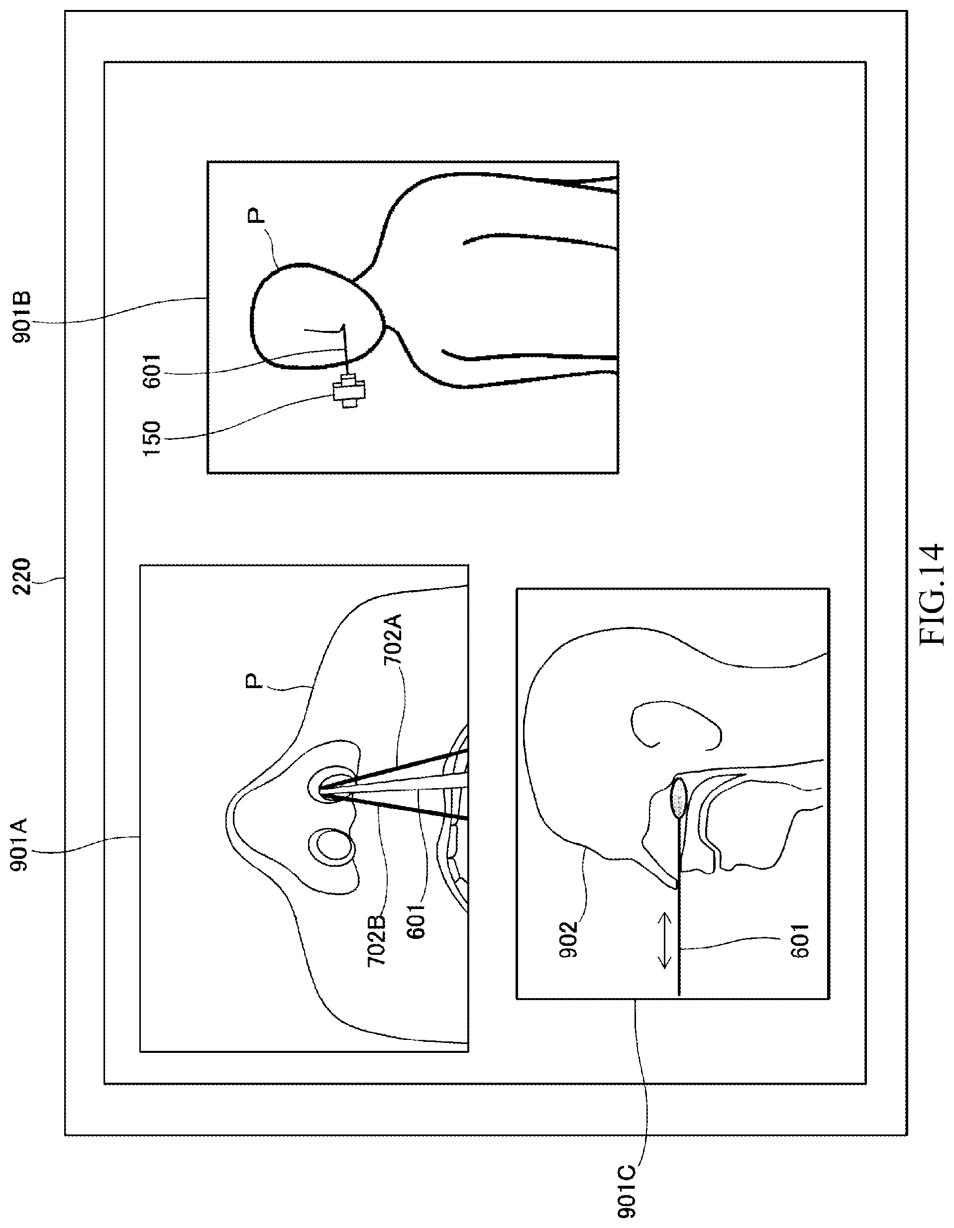 Patent US12310689 Figure 14 – Diagnosis/treatment support robot, diagnosis/treatment support robot system, and diagnosis/treatment support method