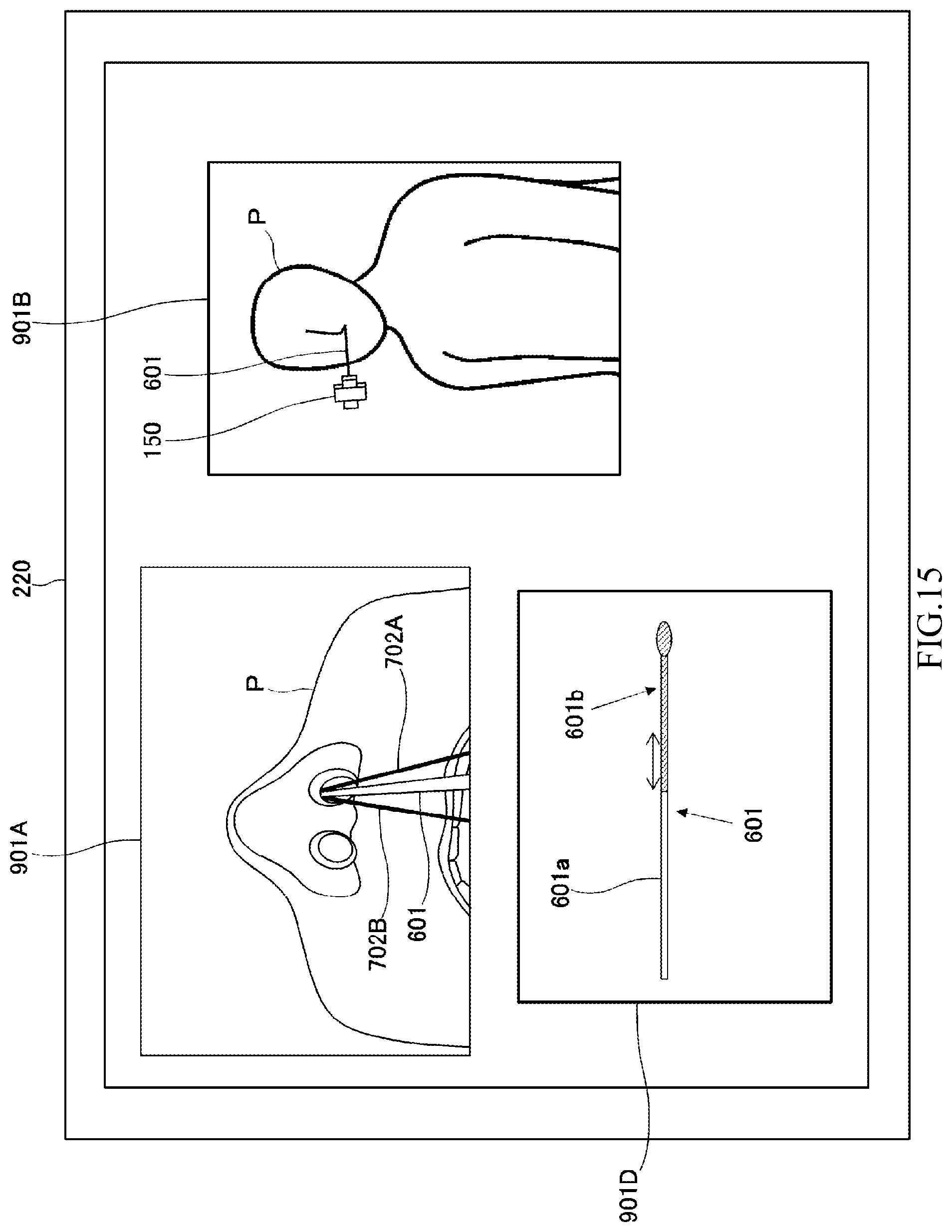 Patent US12310689 Figure 15 – Diagnosis/treatment support robot, diagnosis/treatment support robot system, and diagnosis/treatment support method