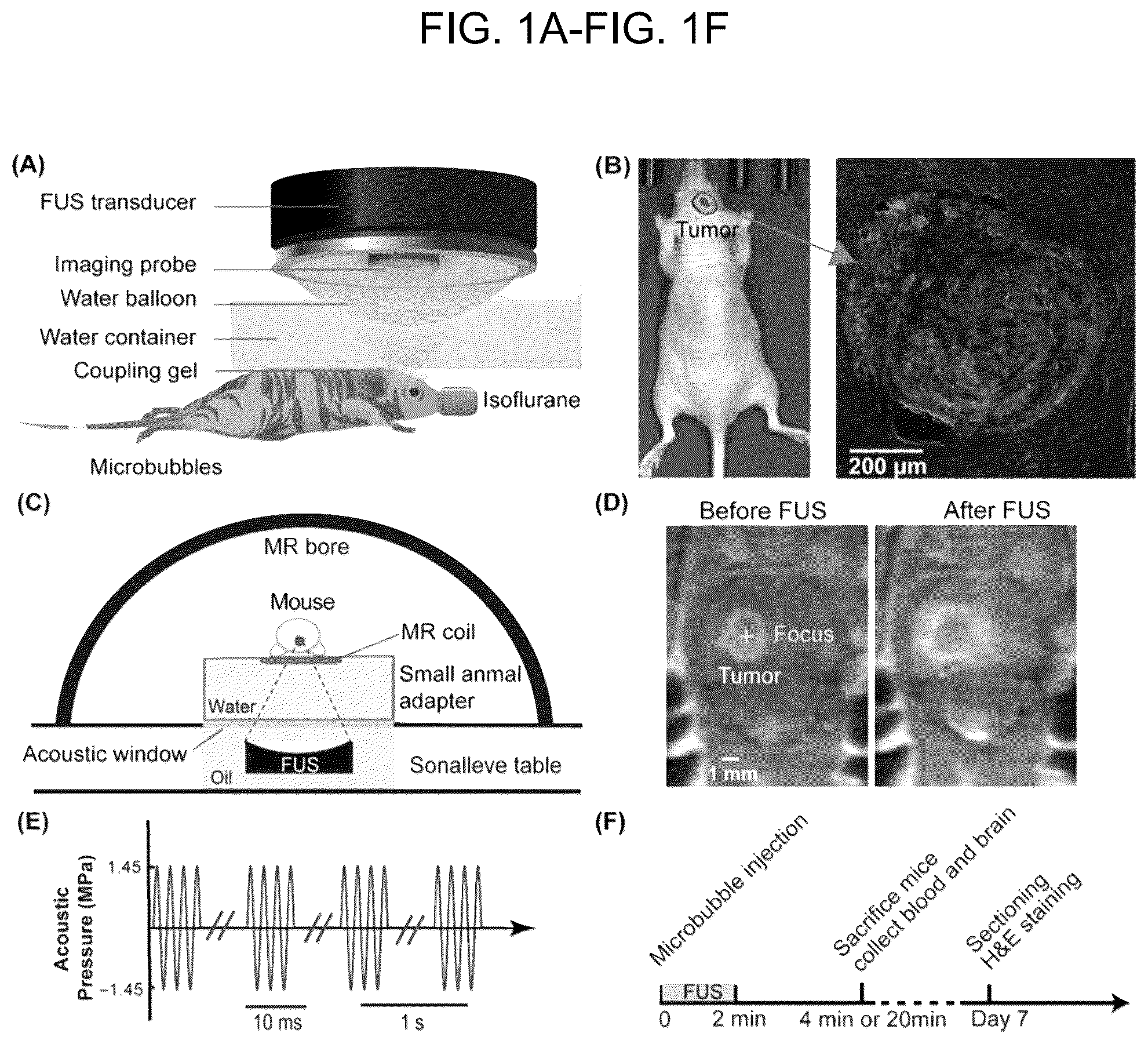 Patent US12310697 — Methods and systems for noninvasive and localized brain liquid biopsy using focused ultrasound — Figure 1