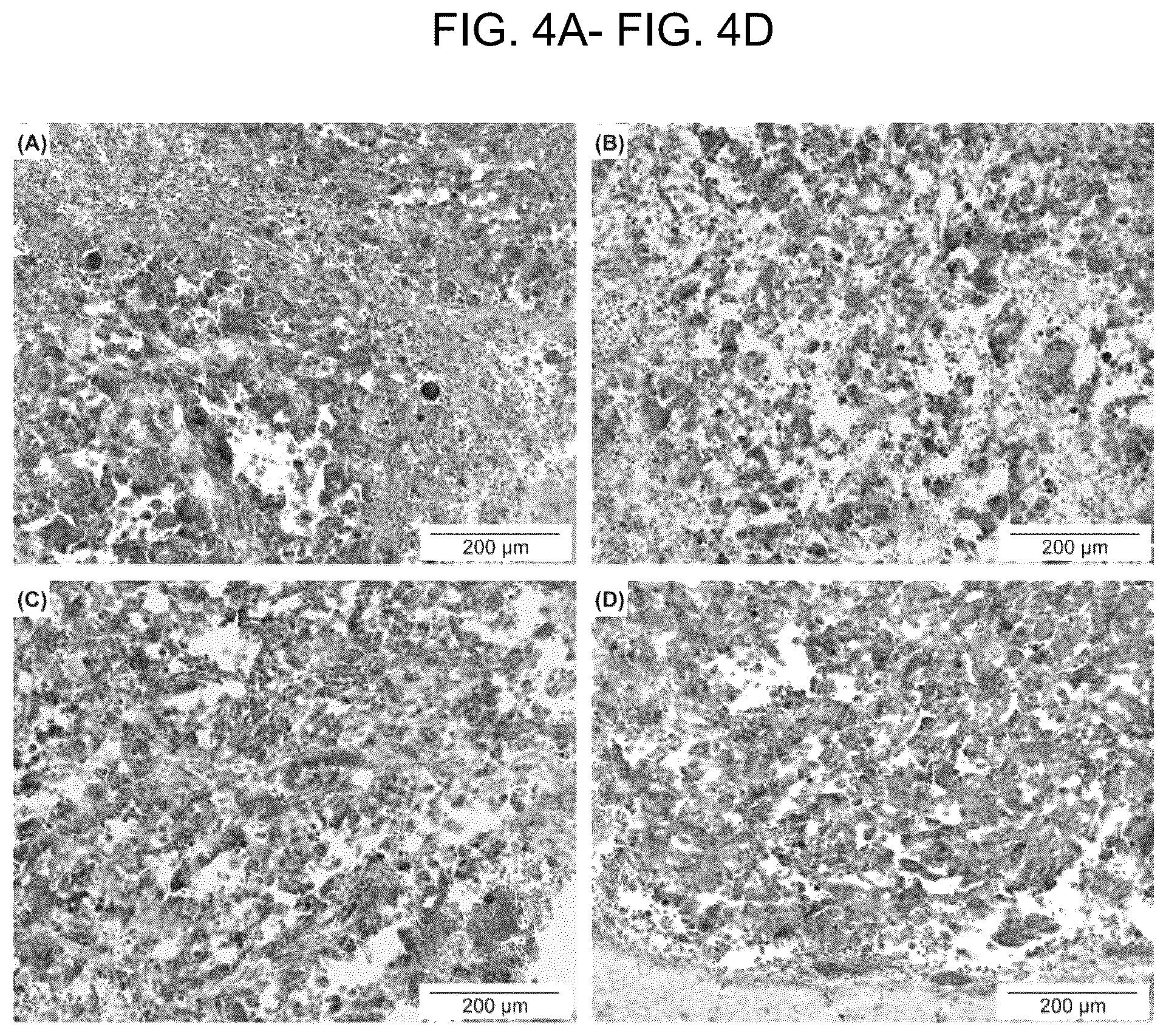 Patent US12310697 Figure 3 – Methods and systems for noninvasive and localized brain liquid biopsy using focused ultrasound