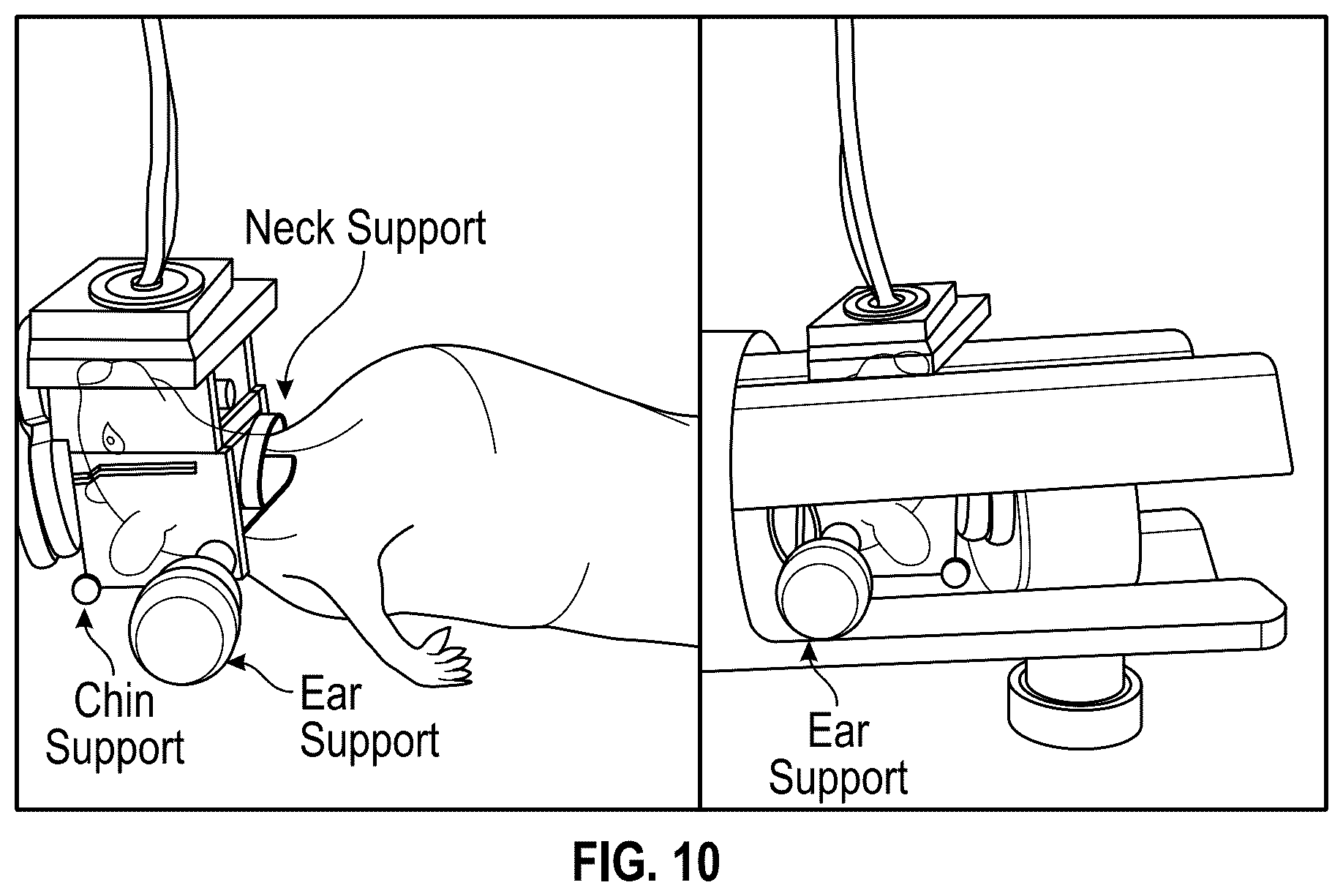 Patent US12310697 Figure 8 – Methods and systems for noninvasive and localized brain liquid biopsy using focused ultrasound