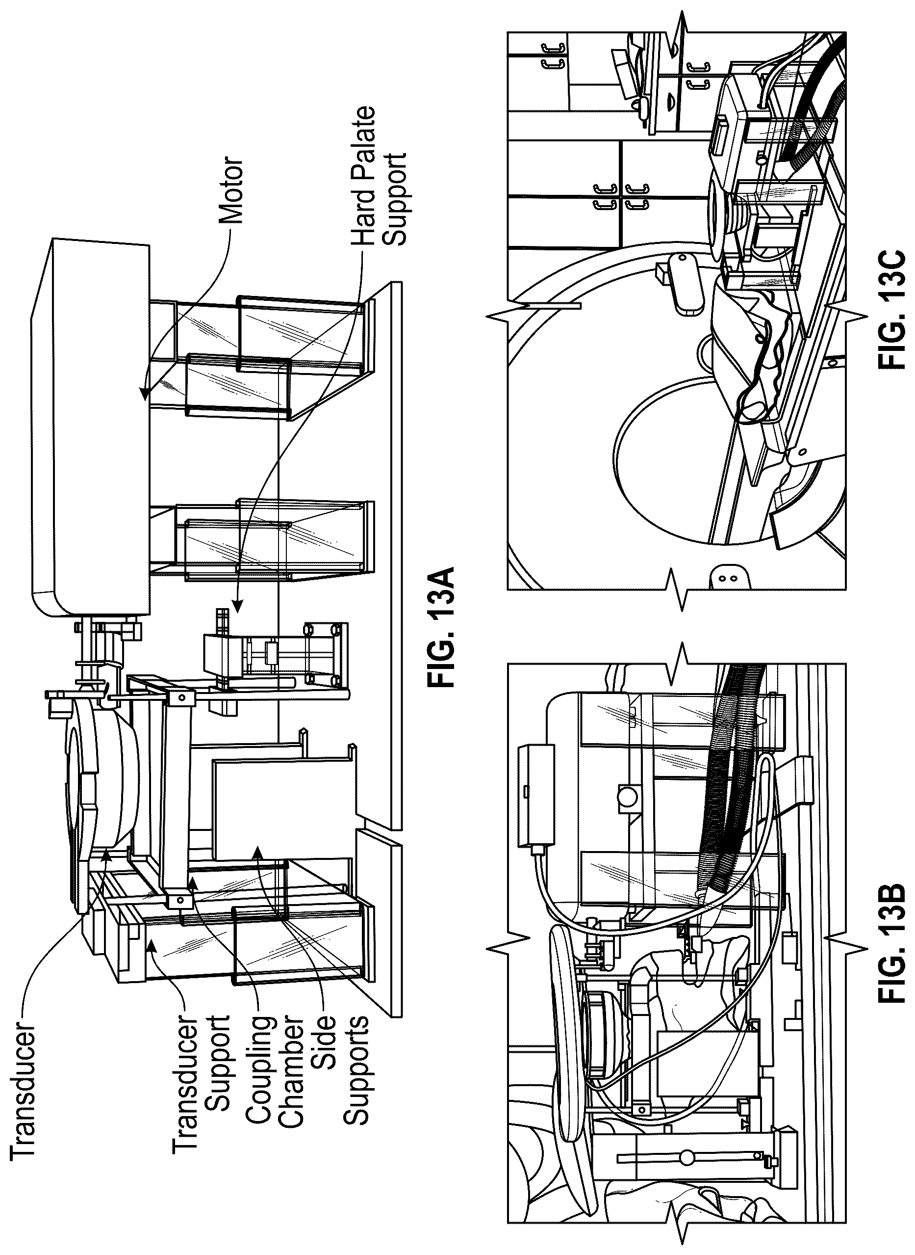 Patent US12310697 Figure 11 – Methods and systems for noninvasive and localized brain liquid biopsy using focused ultrasound