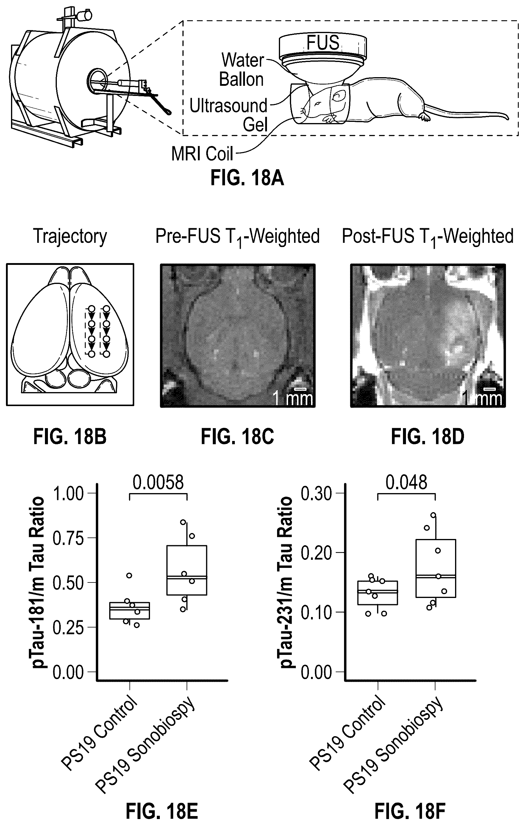 Patent US12310697 Figure 16 – Methods and systems for noninvasive and localized brain liquid biopsy using focused ultrasound
