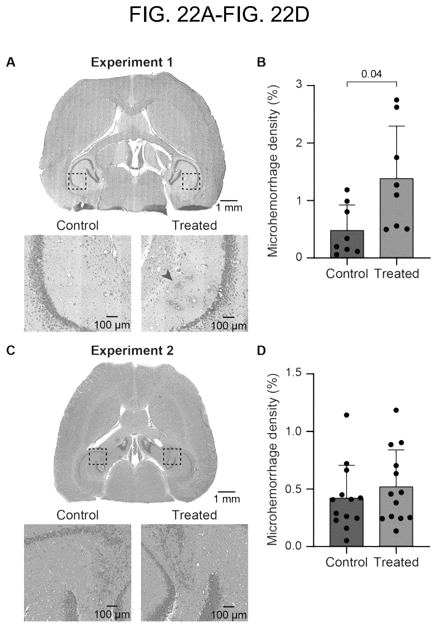Patent US12310697 Figure 20 – Methods and systems for noninvasive and localized brain liquid biopsy using focused ultrasound
