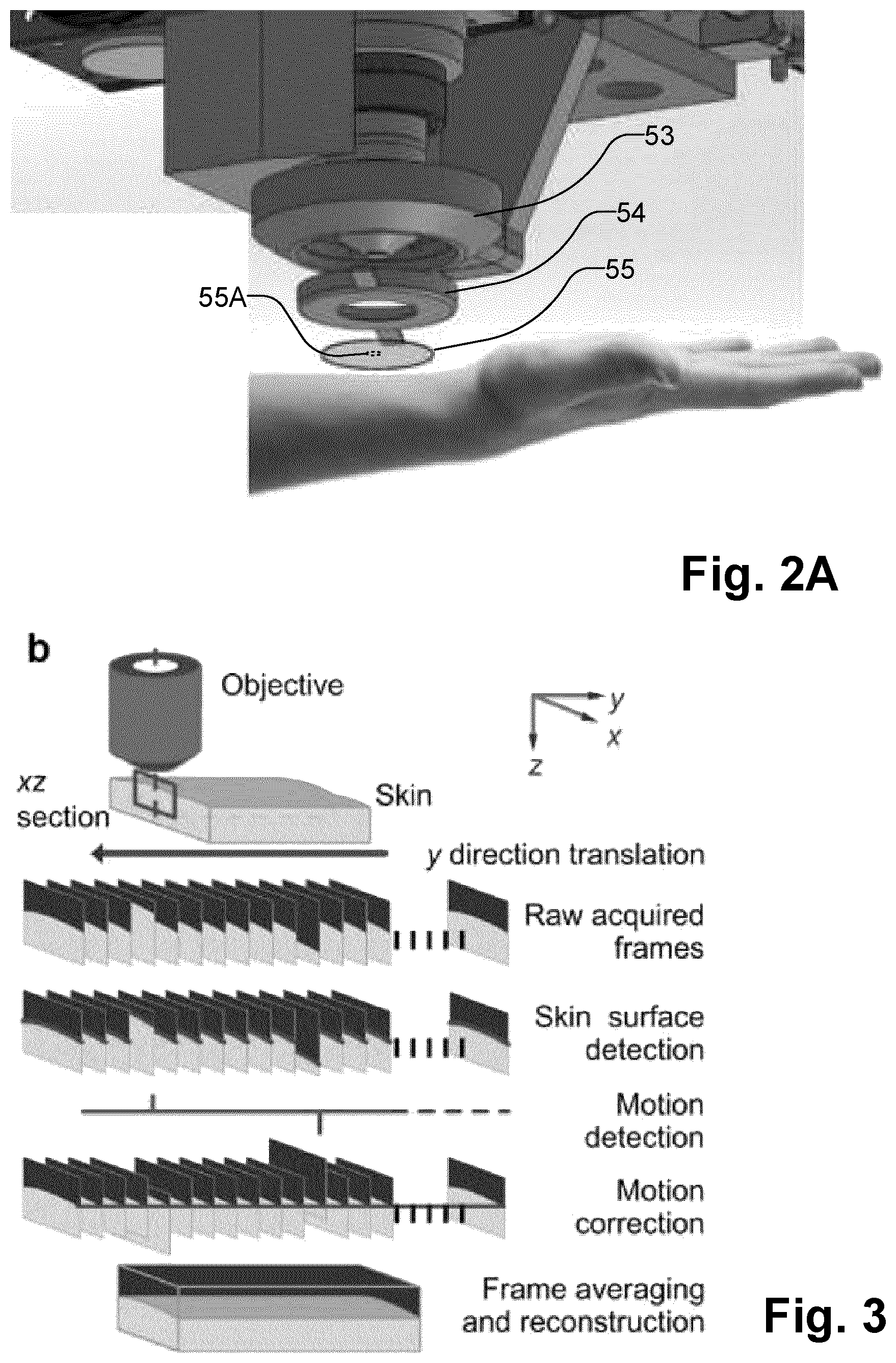 Patent US12310698 Figure 3 – Volumetric multi-modal microscopy methods and systems