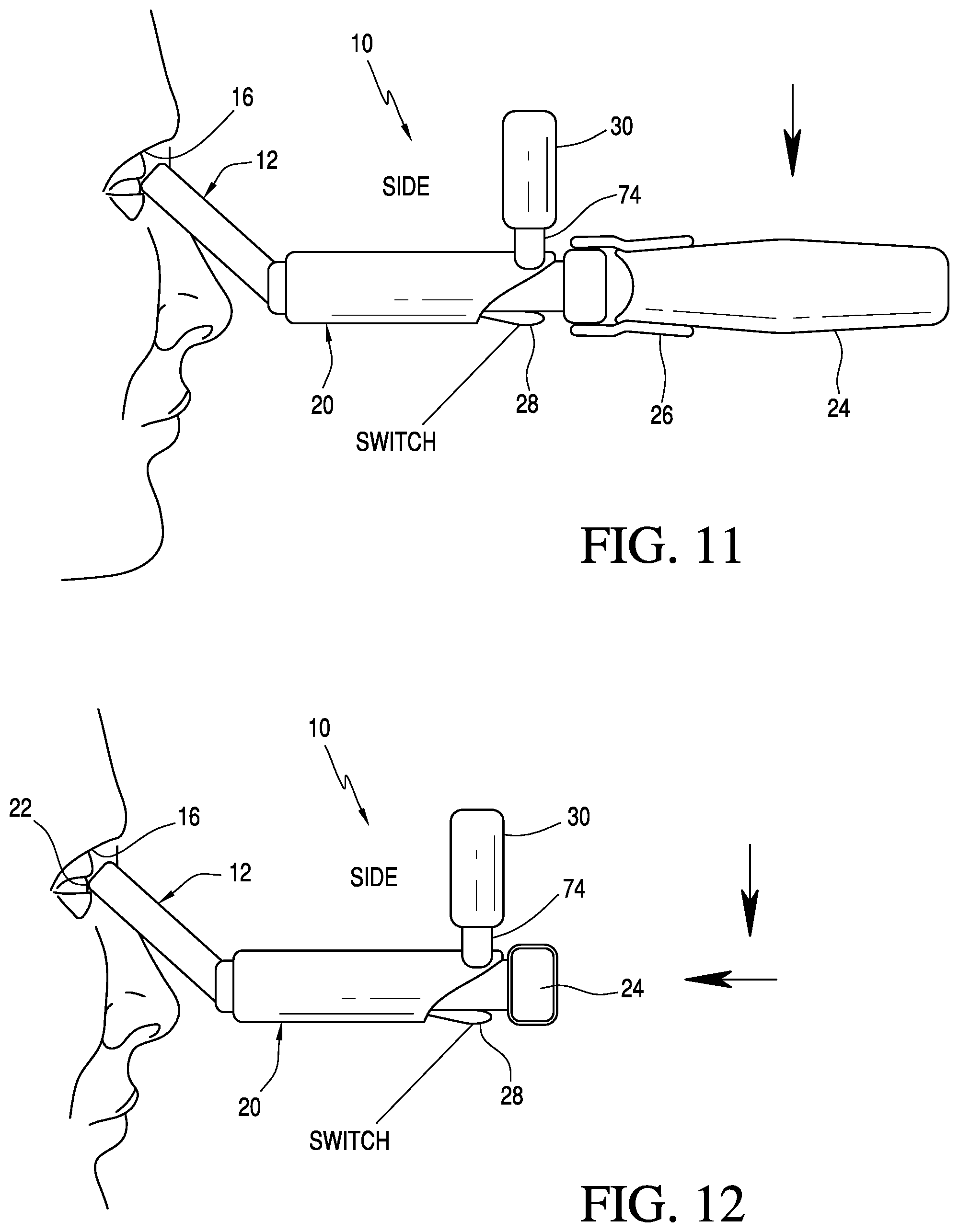 Patent US12310701 Figure 4 – Device for measuring the infrared output of the abreu brain thermal tunnel