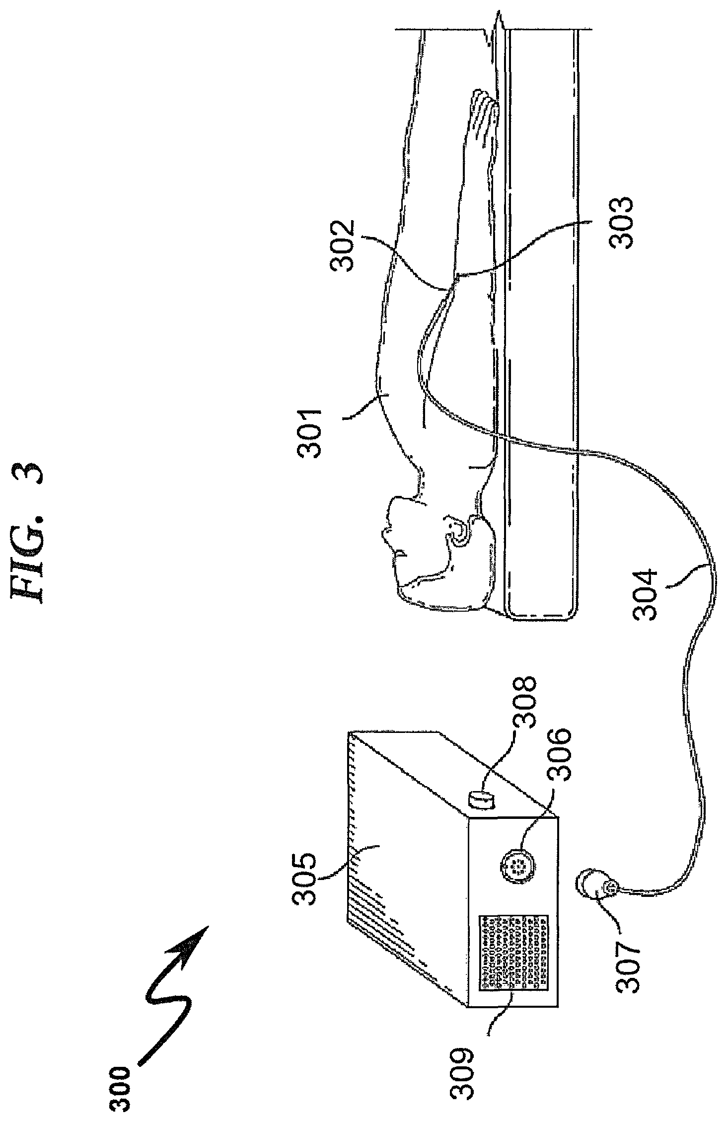 Patent US12310703 Figure 3 – Vascular assessment using statistical analysis of rapid blood pressure readings