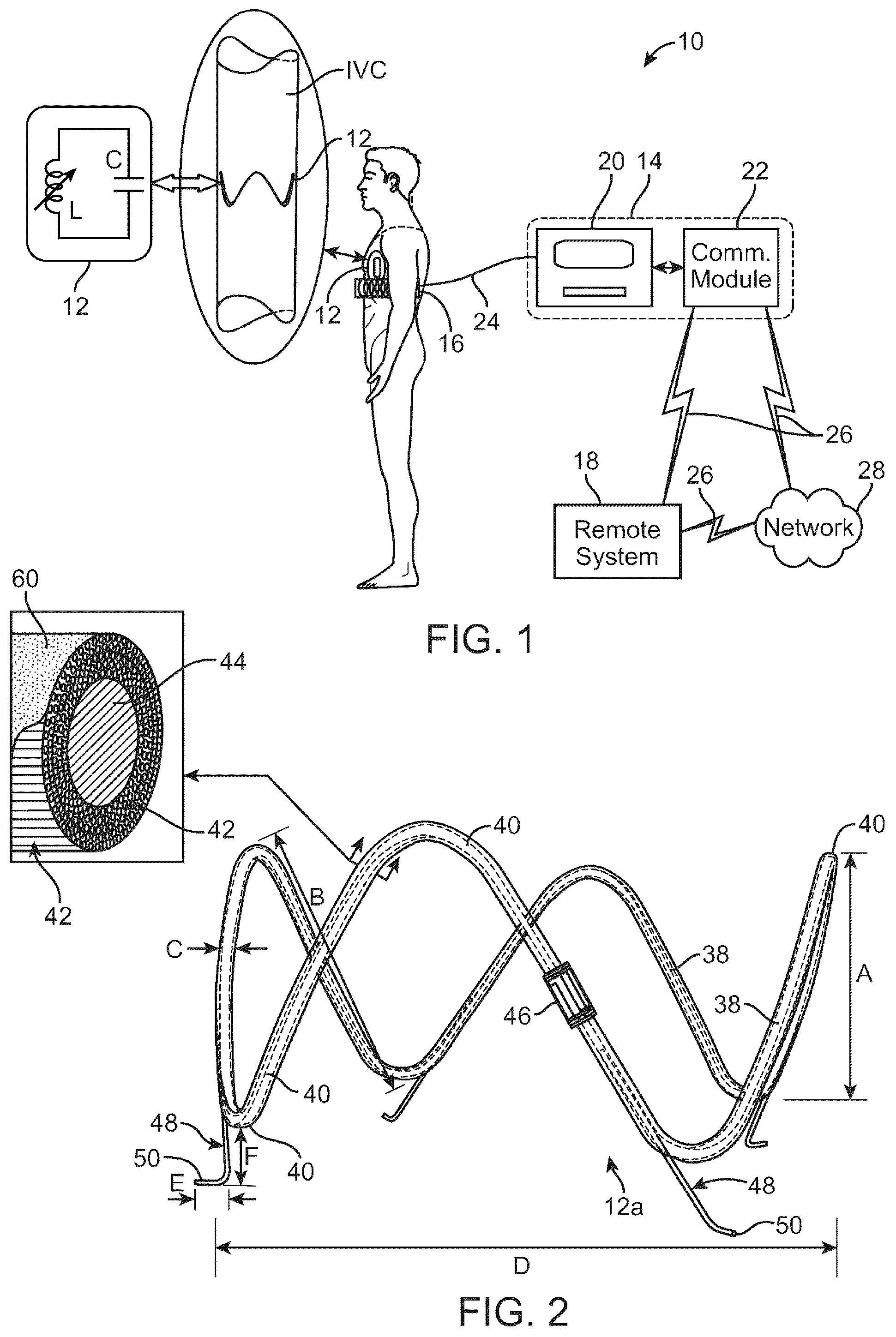 Patent US12310707 Figure 1 – Wireless resonant circuit and variable inductance vascular monitoring implants and anchoring structures therefore