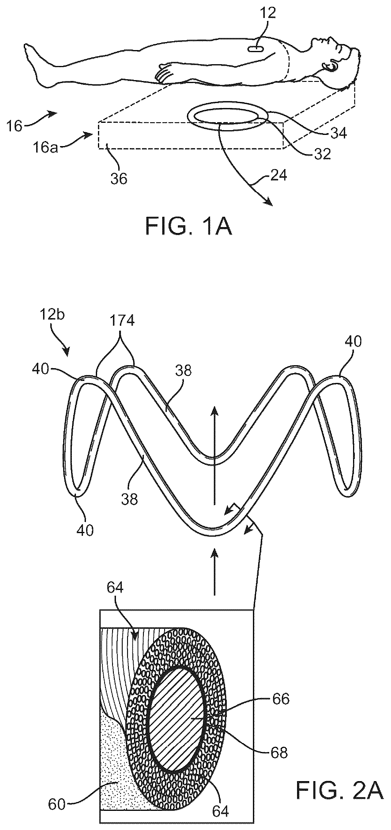 Patent US12310707 Figure 2 – Wireless resonant circuit and variable inductance vascular monitoring implants and anchoring structures therefore