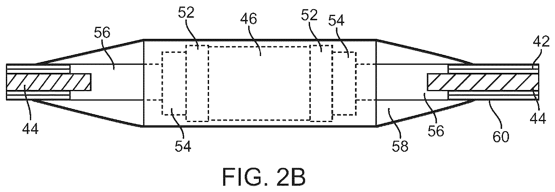 Patent US12310707 Figure 3 – Wireless resonant circuit and variable inductance vascular monitoring implants and anchoring structures therefore