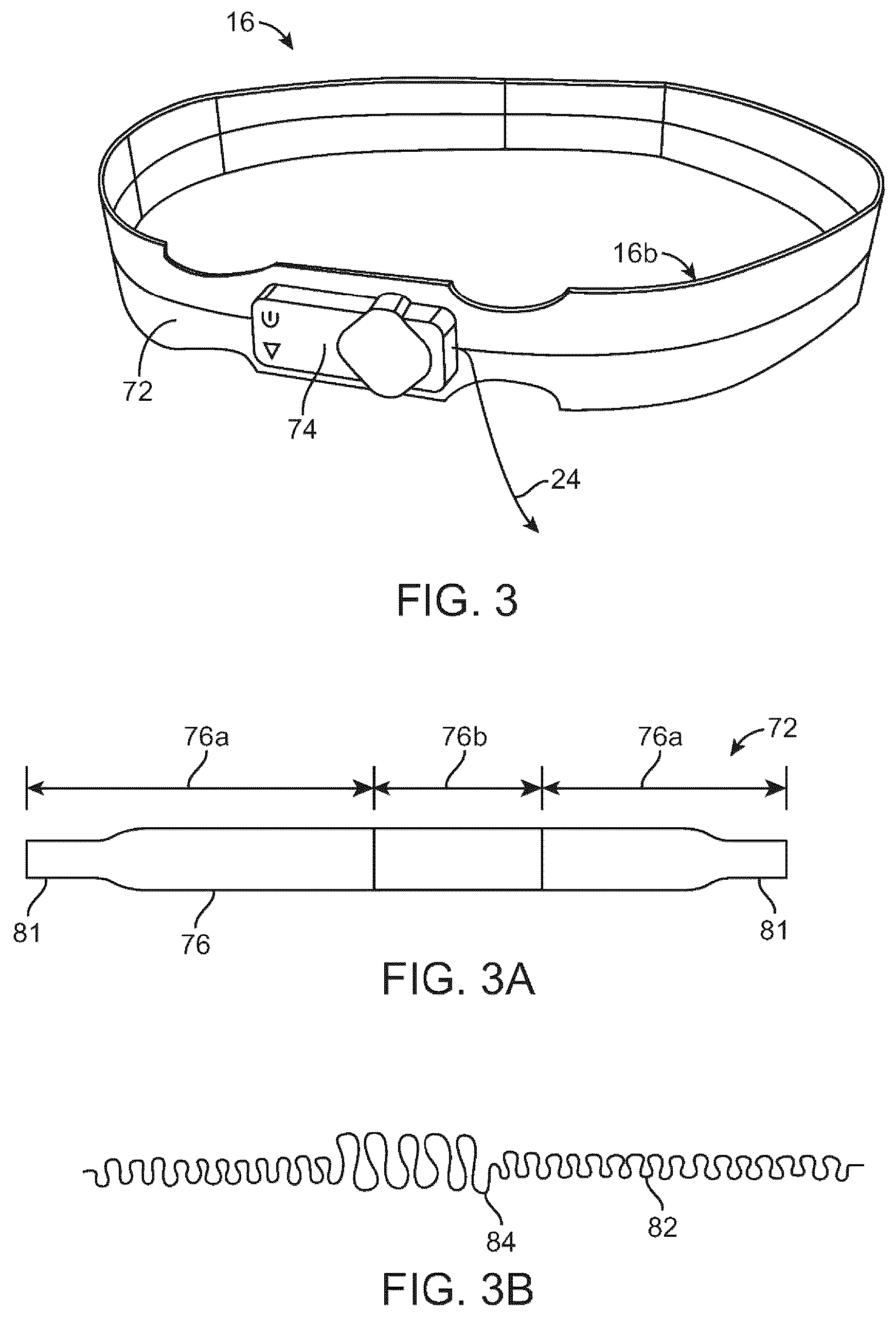 Patent US12310707 Figure 4 – Wireless resonant circuit and variable inductance vascular monitoring implants and anchoring structures therefore