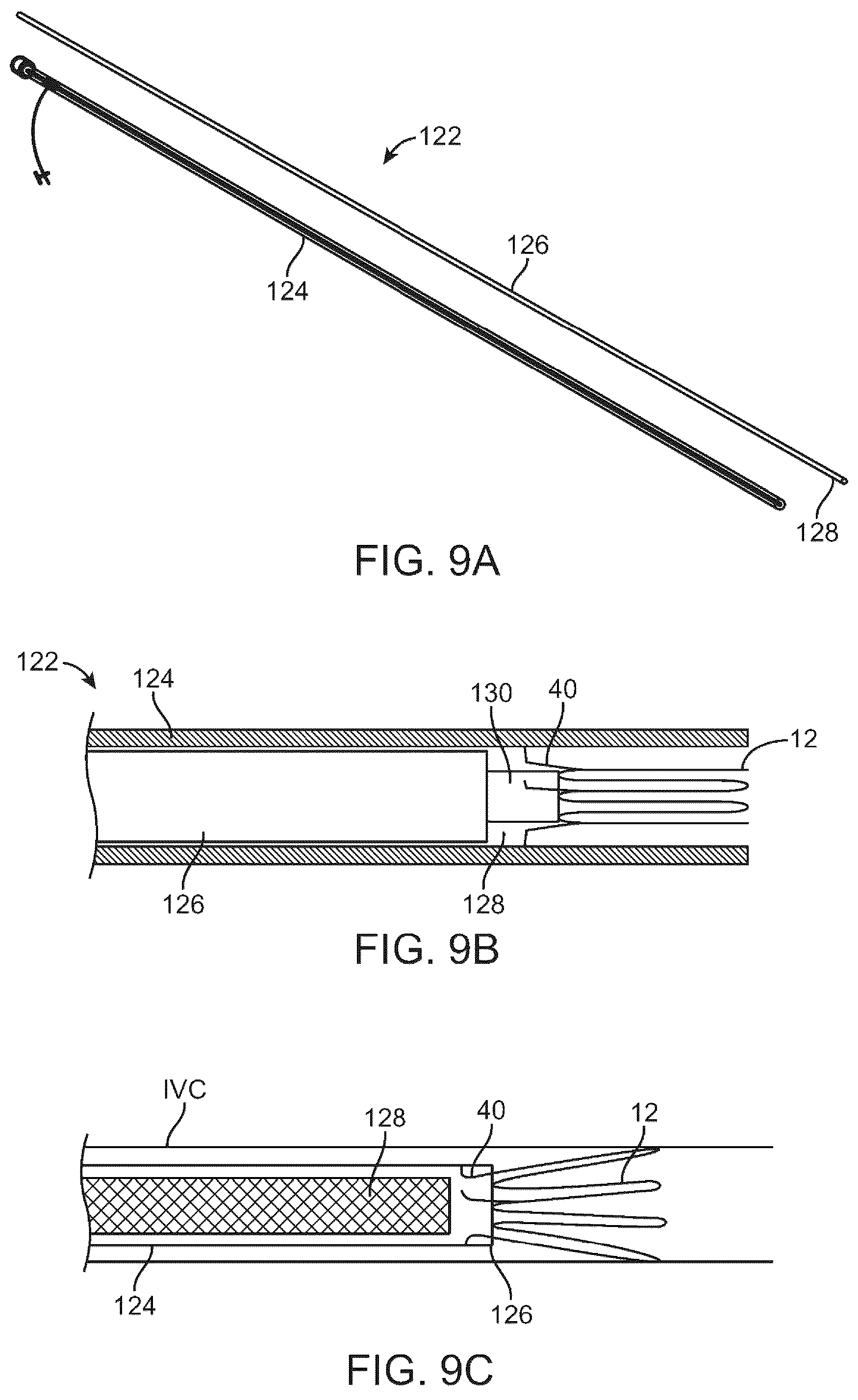 Patent US12310707 Figure 9 – Wireless resonant circuit and variable inductance vascular monitoring implants and anchoring structures therefore