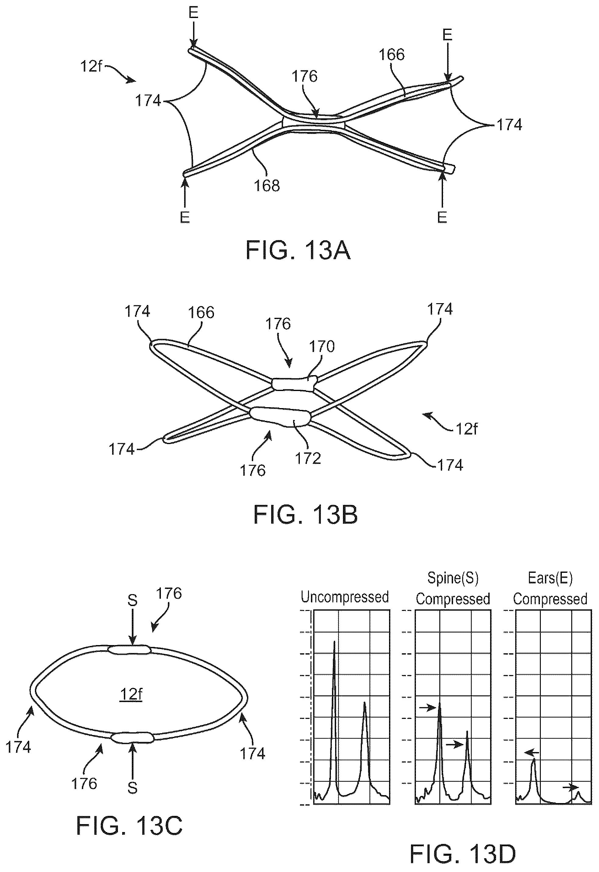Patent US12310707 Figure 16 – Wireless resonant circuit and variable inductance vascular monitoring implants and anchoring structures therefore