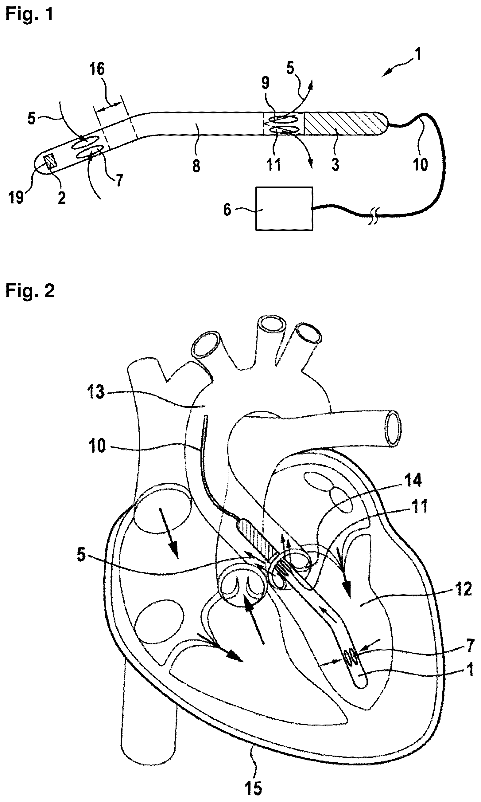 Patent US12310708 Figure 1 – Systems and methods for determining a flow speed of a fluid flowing through a cardiac assist device