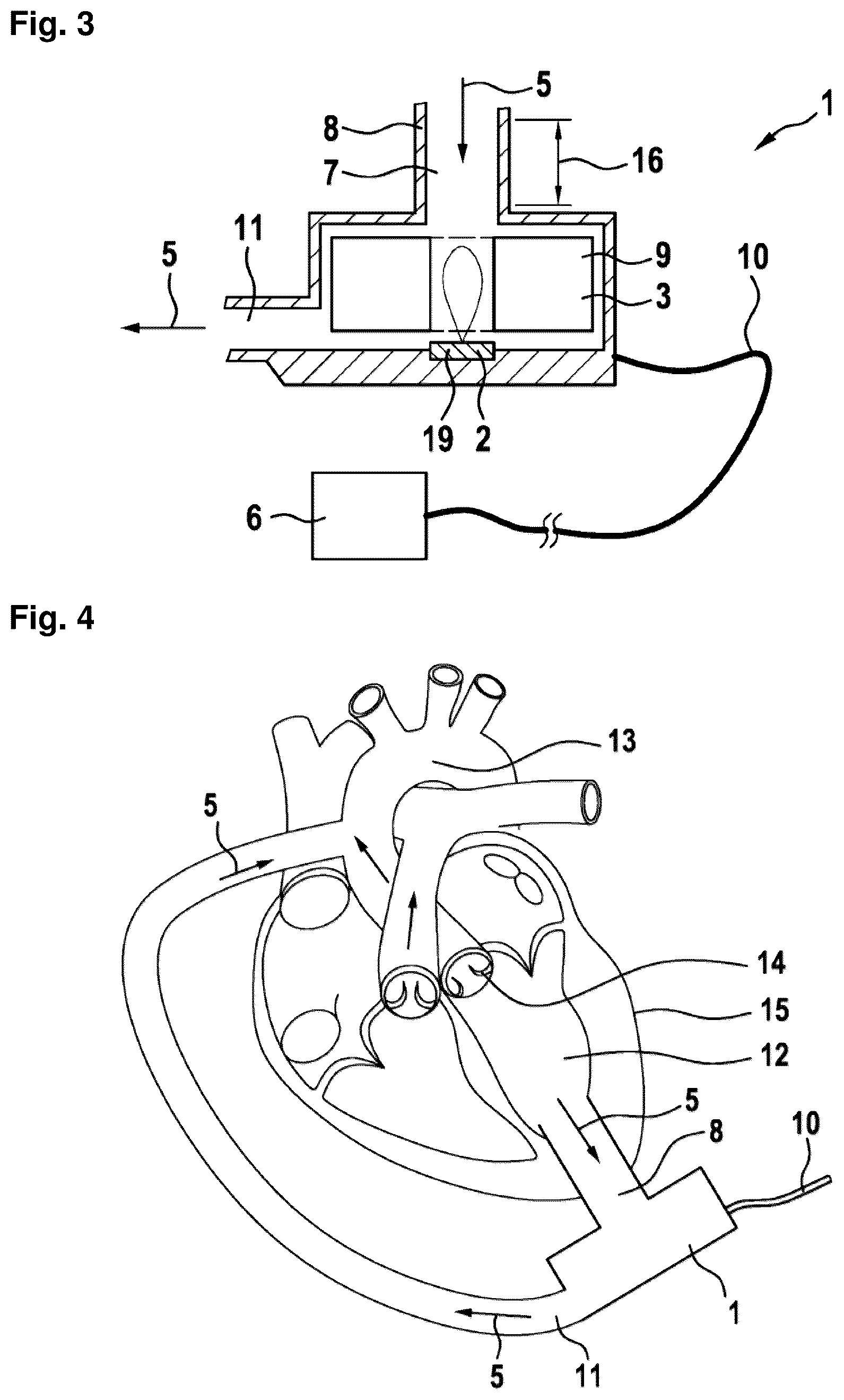 Patent US12310708 Figure 2 – Systems and methods for determining a flow speed of a fluid flowing through a cardiac assist device