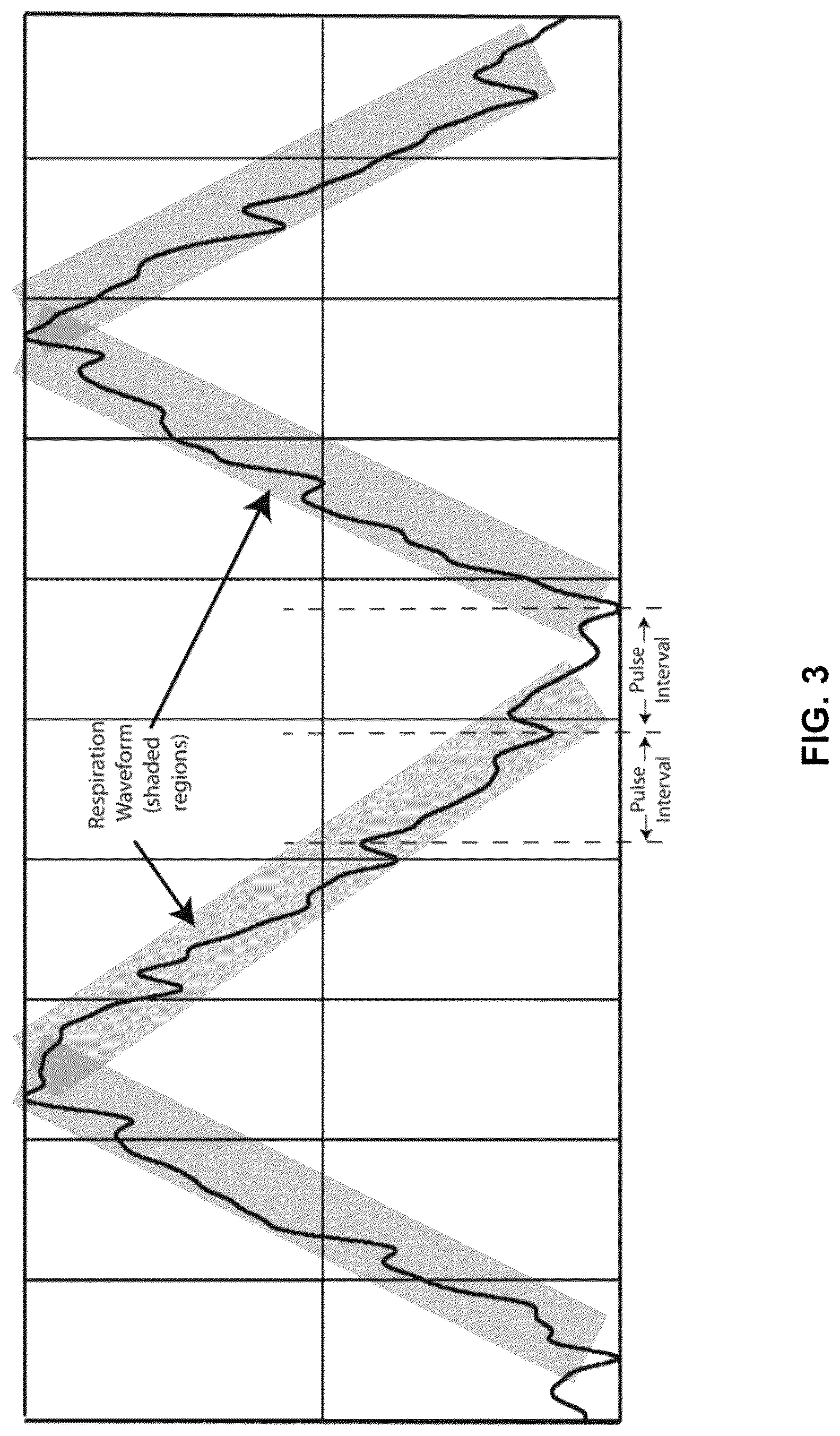 Patent US12310709 Figure 3 – Computation of parameters of a body using an electric field