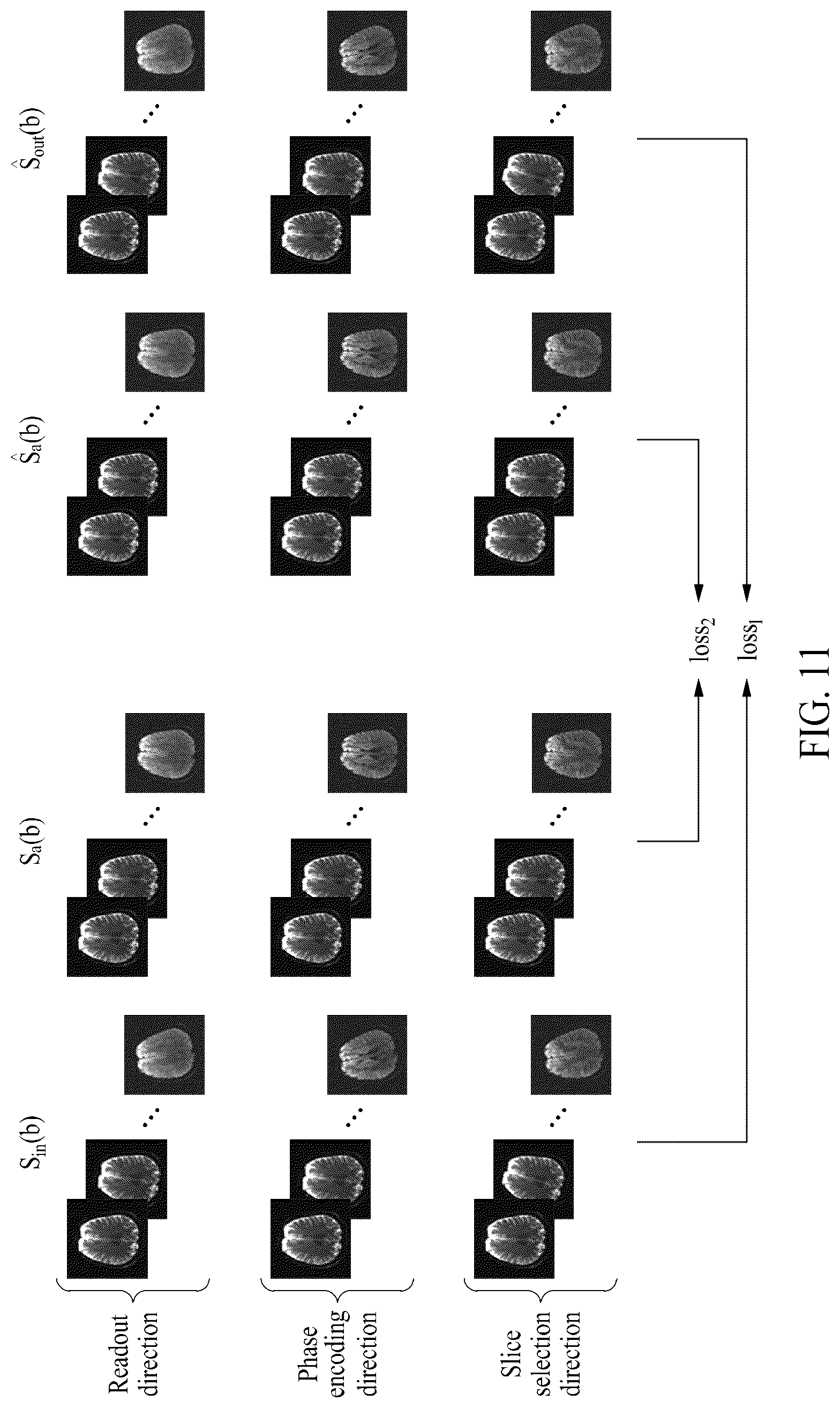 Patent US12310713 Figure 11 – Method of quantifying magnetic resonance diffusion parameters by using diffusion weighted magnetic resonance images
